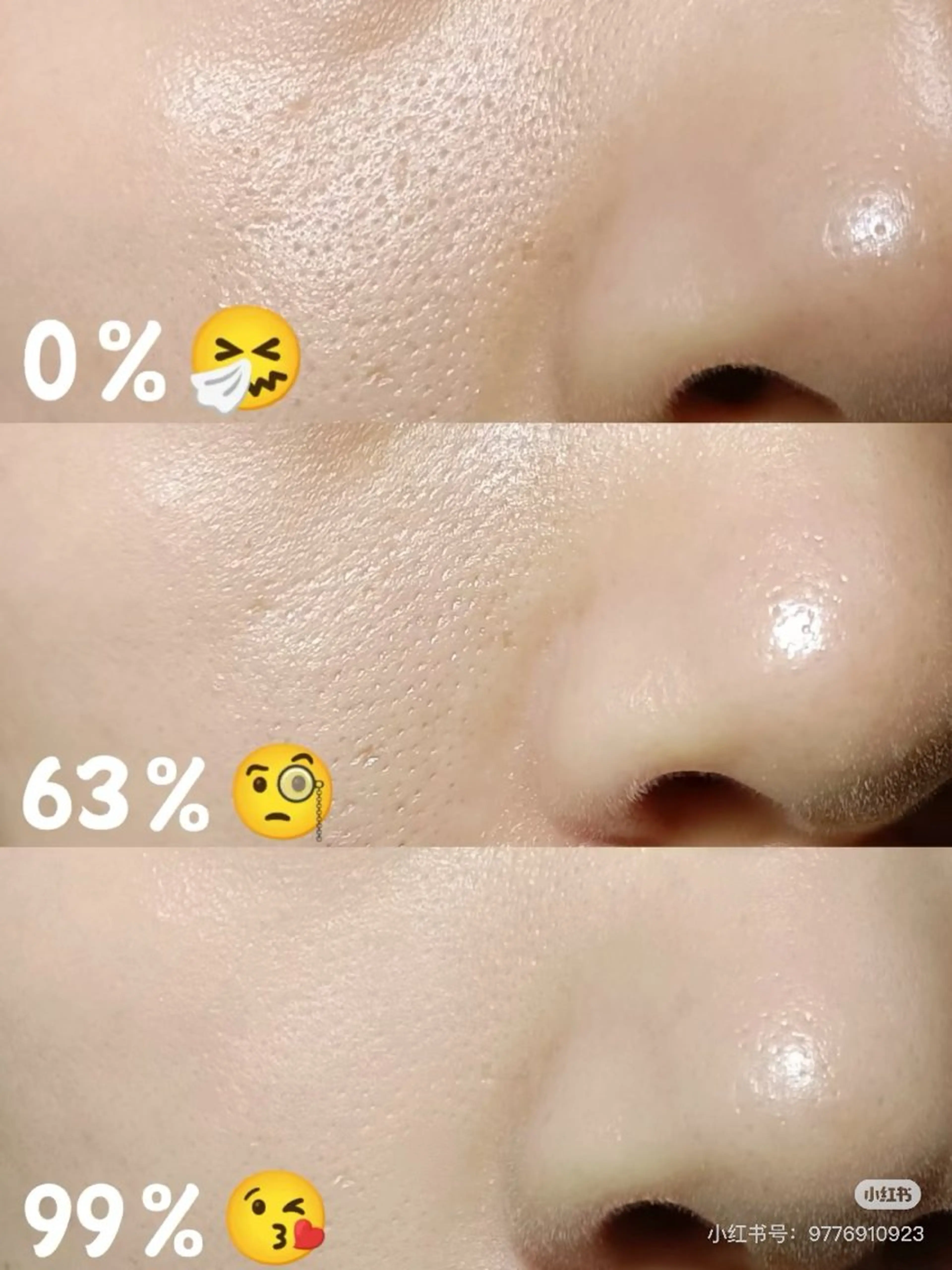 ネイル エステ aliaハイフ&水光ジェットサロン所属・aliaハーブ水光店 エステティシャン募集のエステ・リラクイメージ