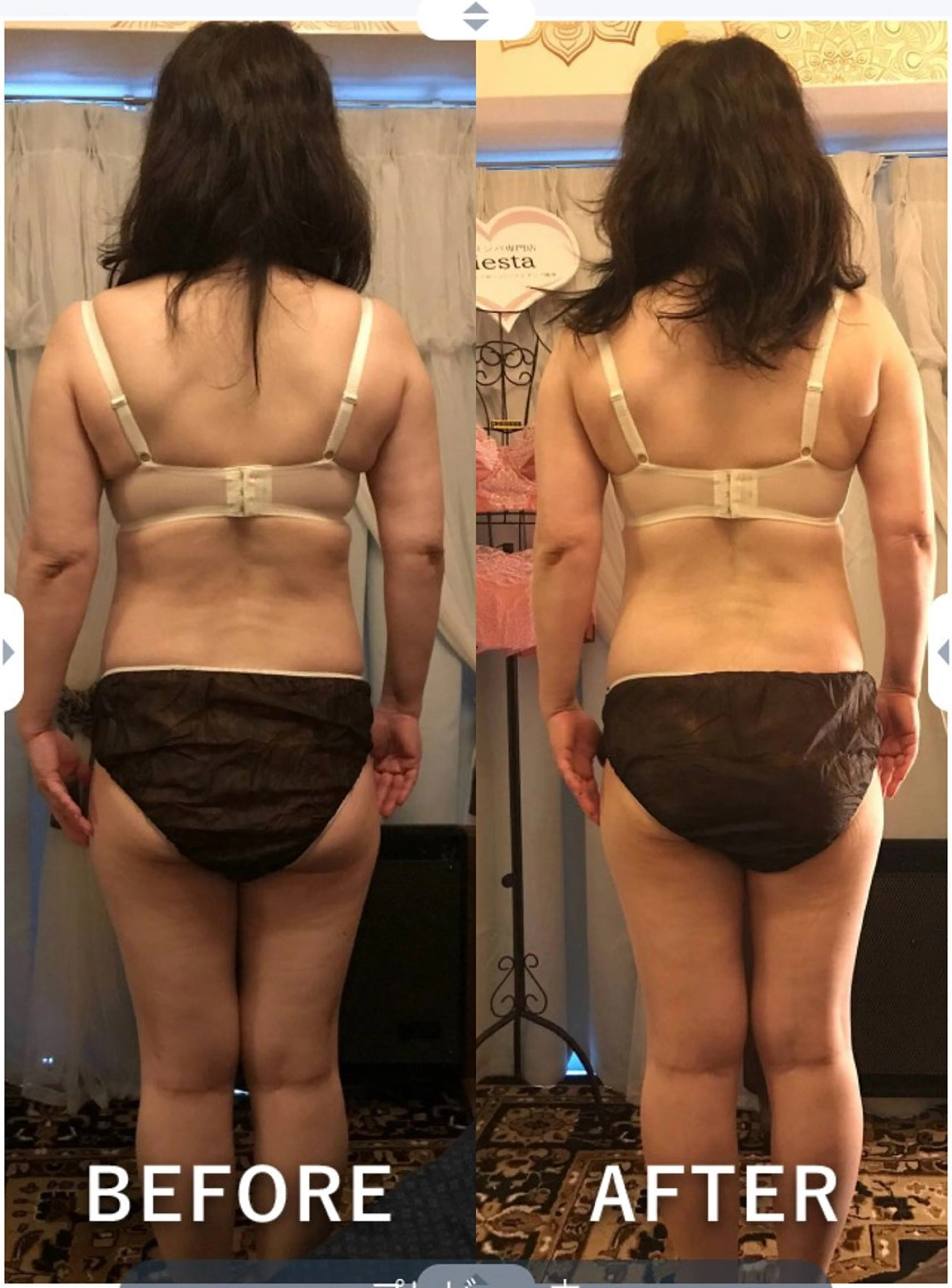 【美脚】微弱電流+リンパ60分(セル脂肪、脚のみむくみとり極楽リンパマッサージ)の写真