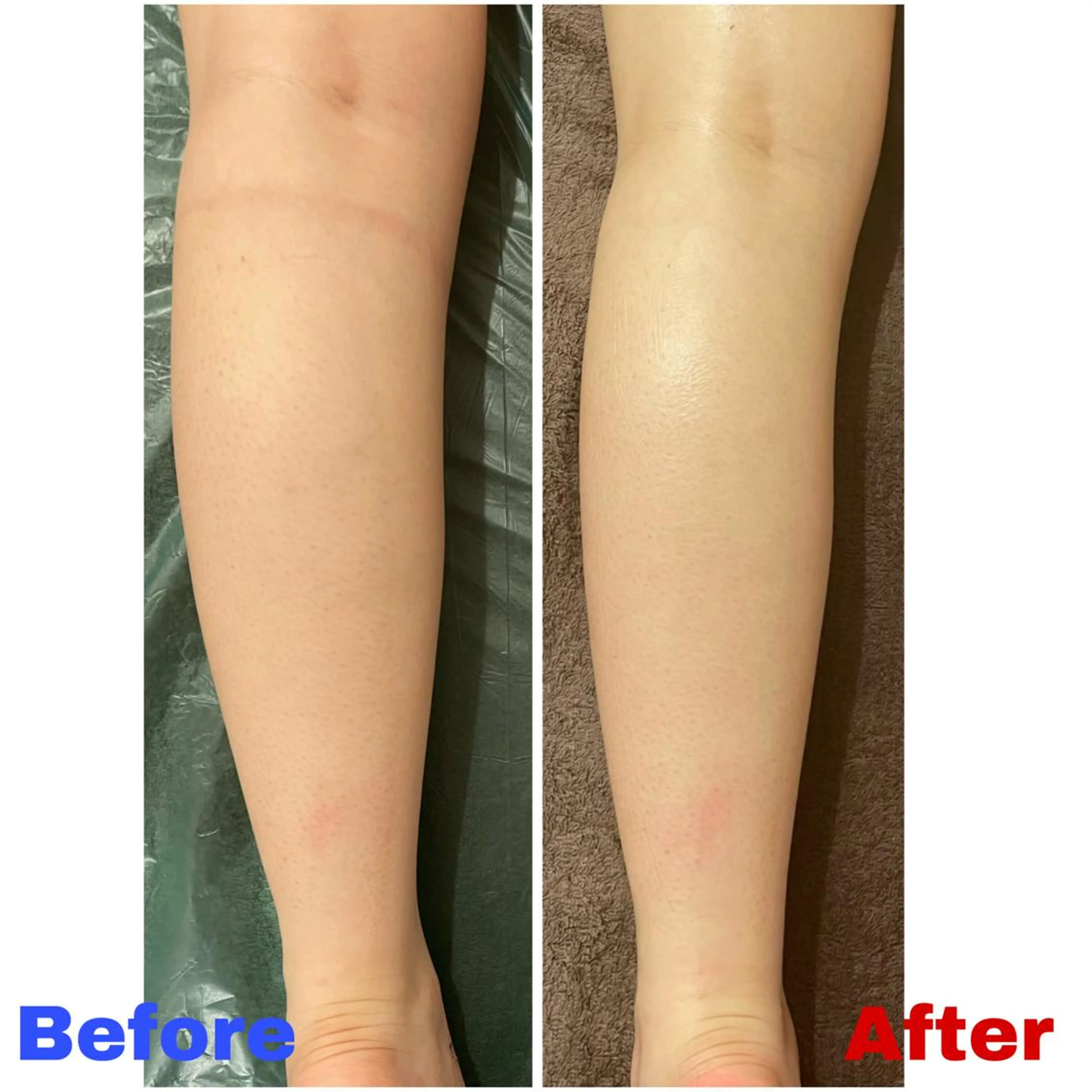 【18~29歳女性限定‼️】むくみサヨナラ！🍃リンパドレナージュの写真