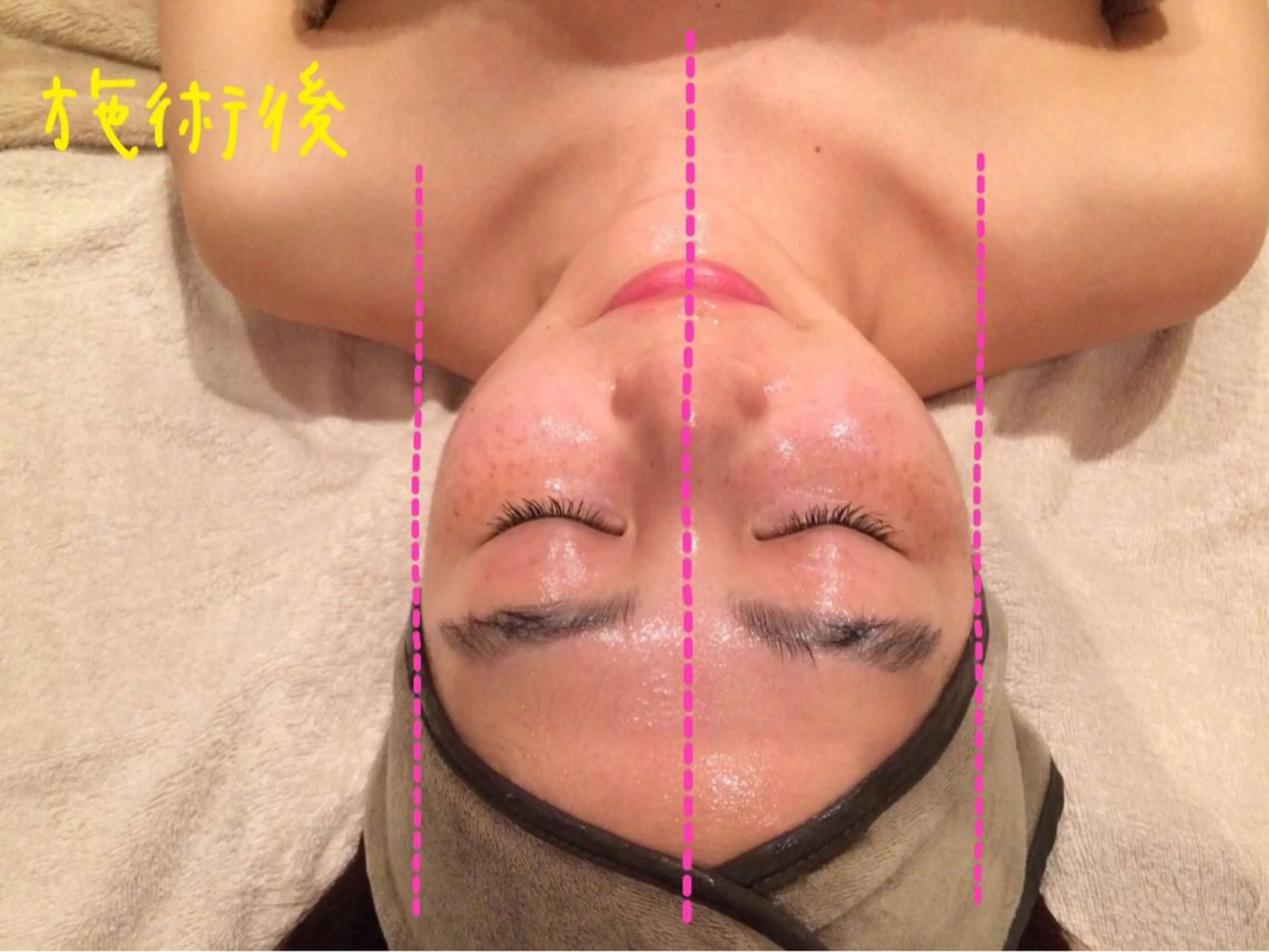 エステ リラク 韓国コルギ ハーブピーリング専門  ALMOND所属・ALMOND yukinaのエステ・リラクイメージ