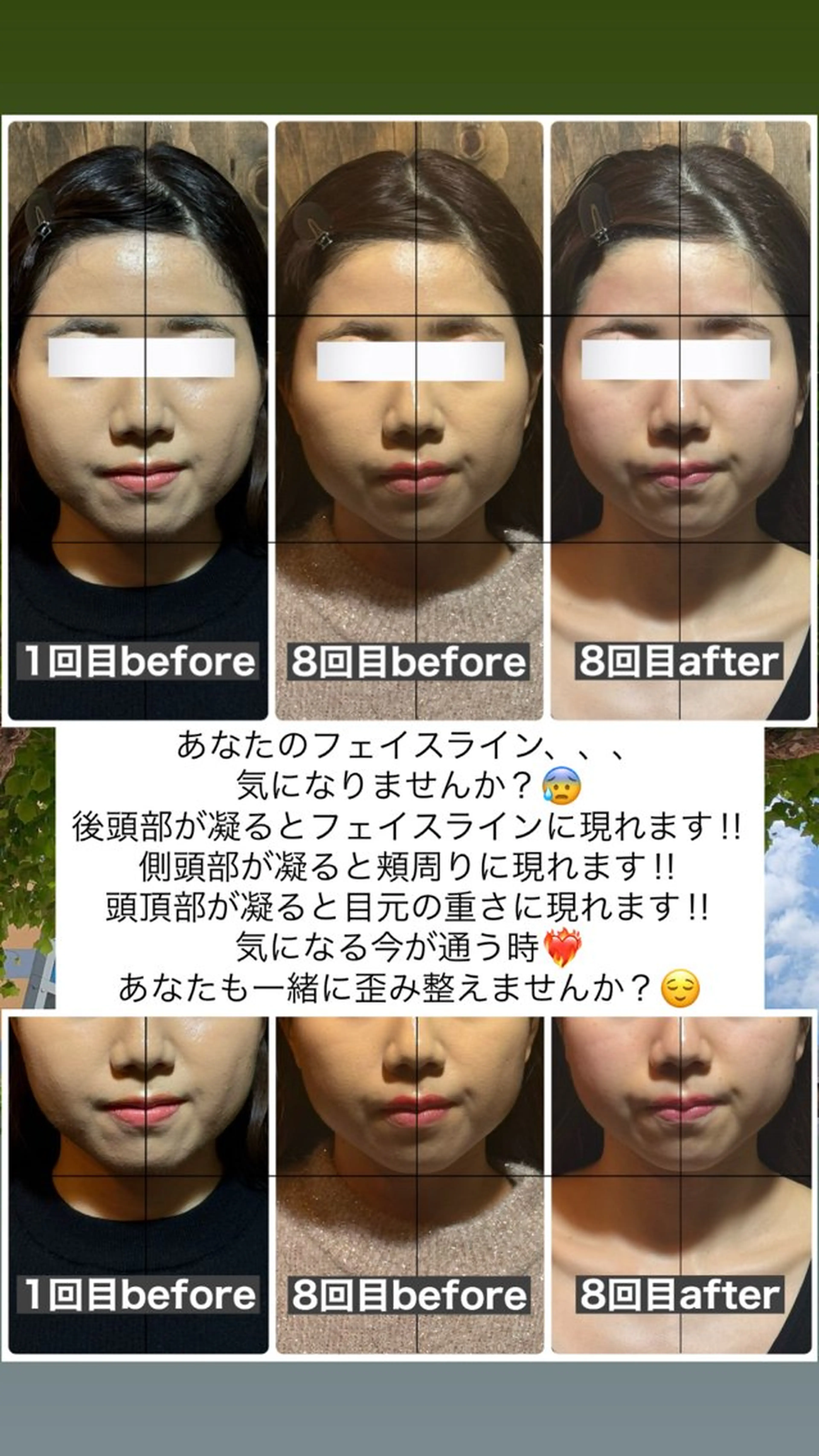 エステ リラク 💎後悔させない小顔 矯正💎イトヤマ🌱のエステ・リラクイメージ