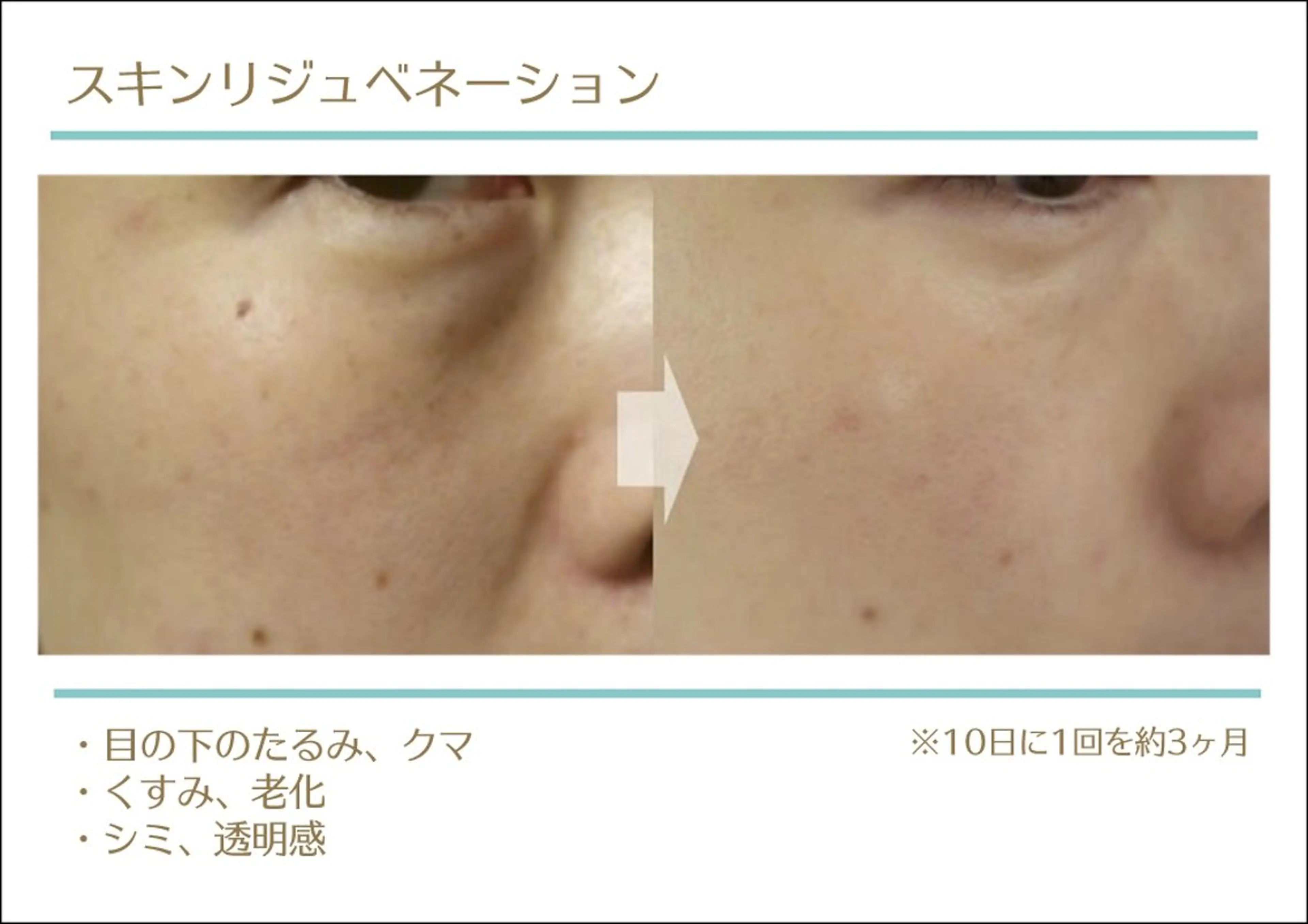 撮影モデル total beauty HAPPY所属・O. Minaのその他イメージ