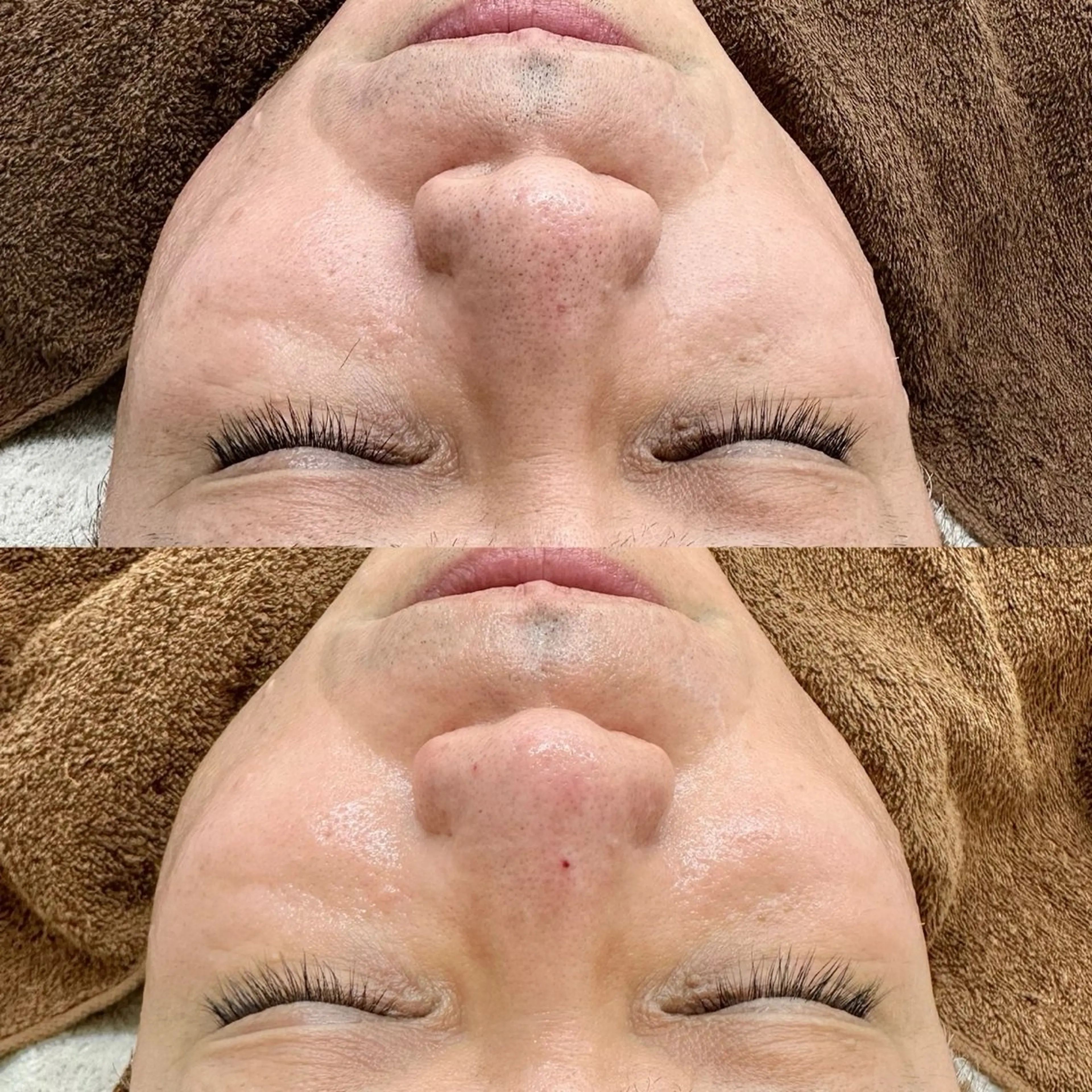 メンズ エステ Lei beauty salon所属・松ヤニワックス専門/ 梅田/Leiのエステ・リラクイメージ