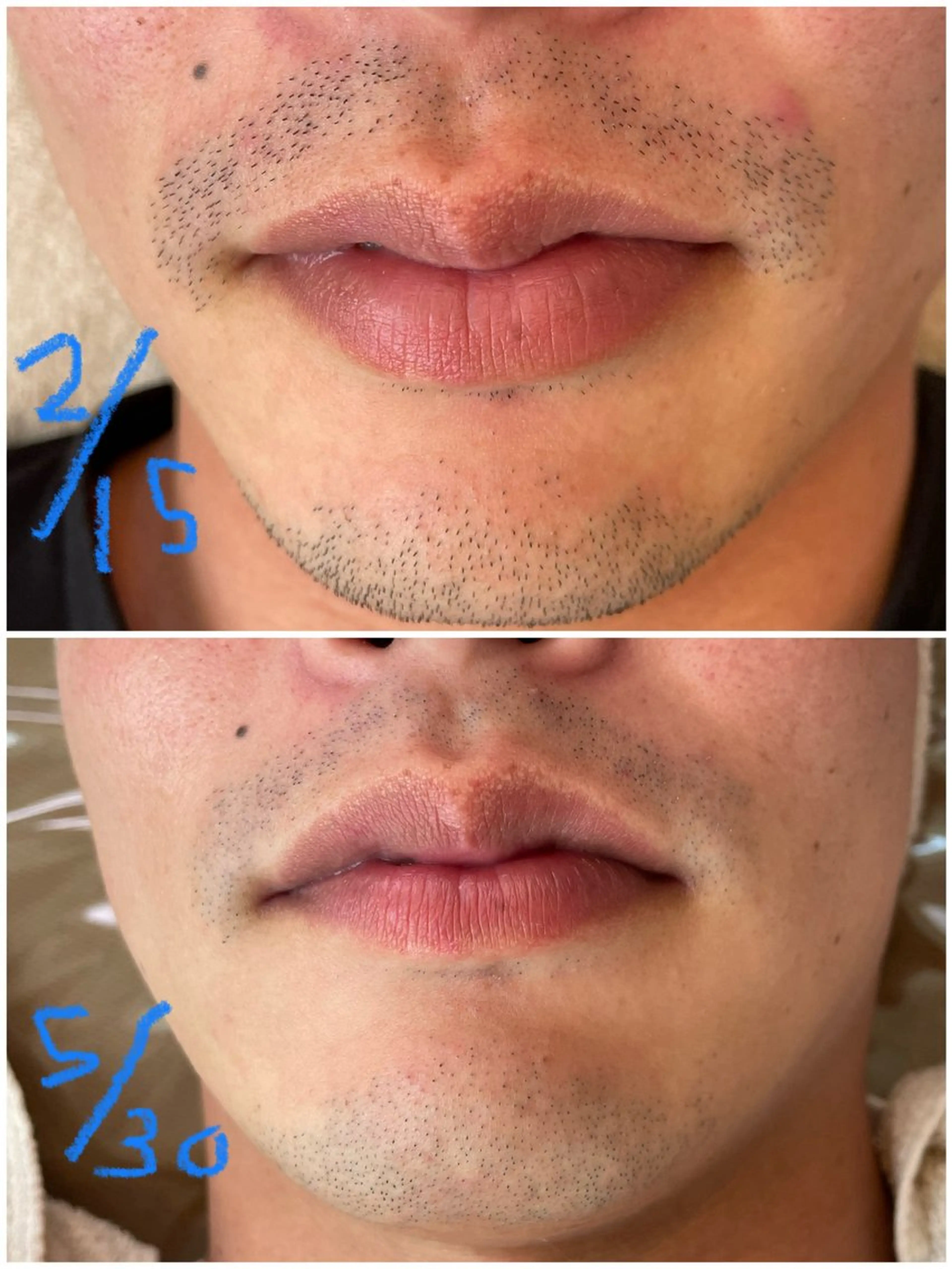 メンズ 脱毛 private salon VIALL所属・プライベートサロン VIALLのエステ・リラクイメージ