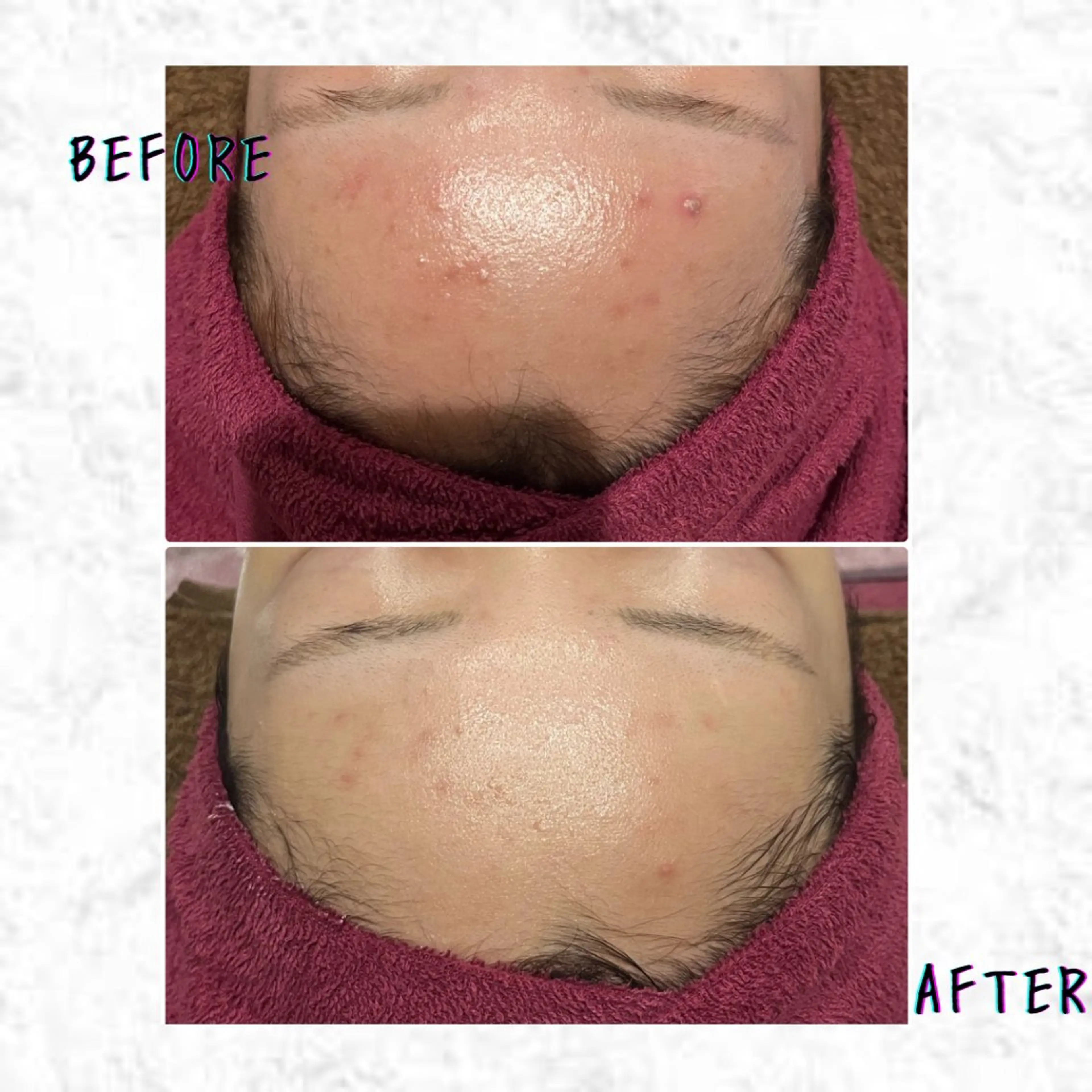 【練習モデル】エンビロントリートメントの写真