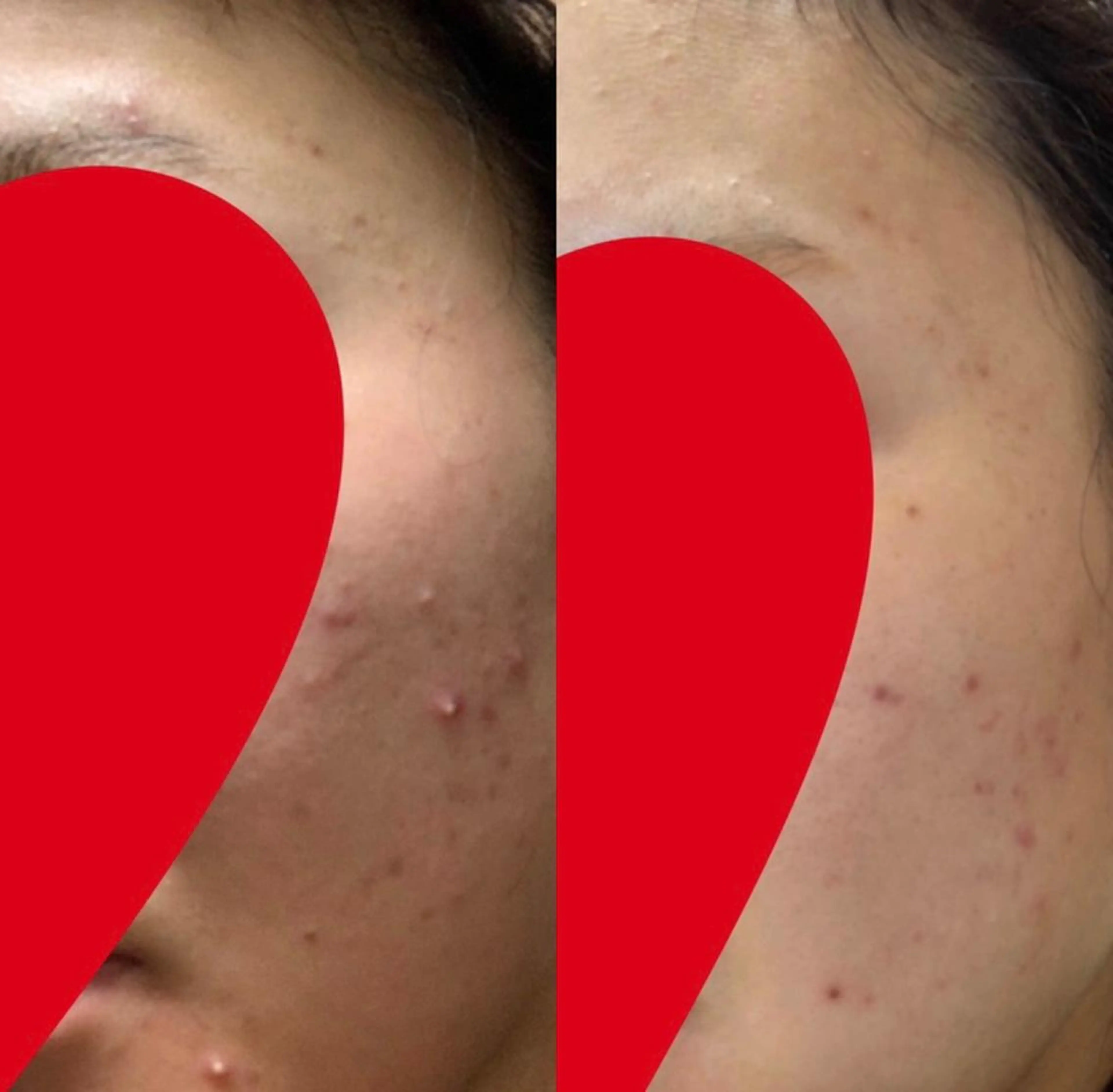 POLA御堂筋本町駅前店所属・畠中 由乃のエステ・リラクイメージ