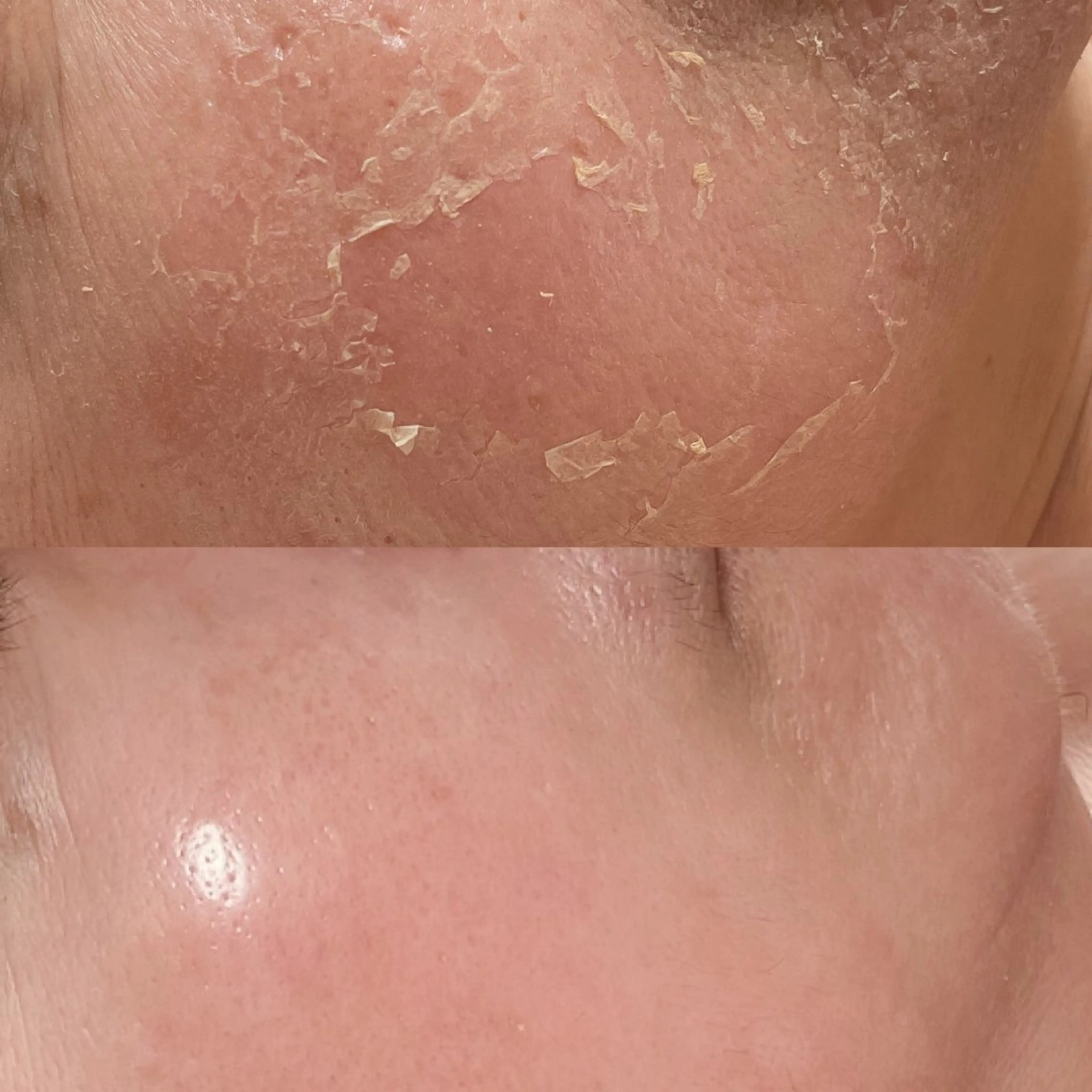 【5daysご予約の方専用】アフタートリートメントの写真