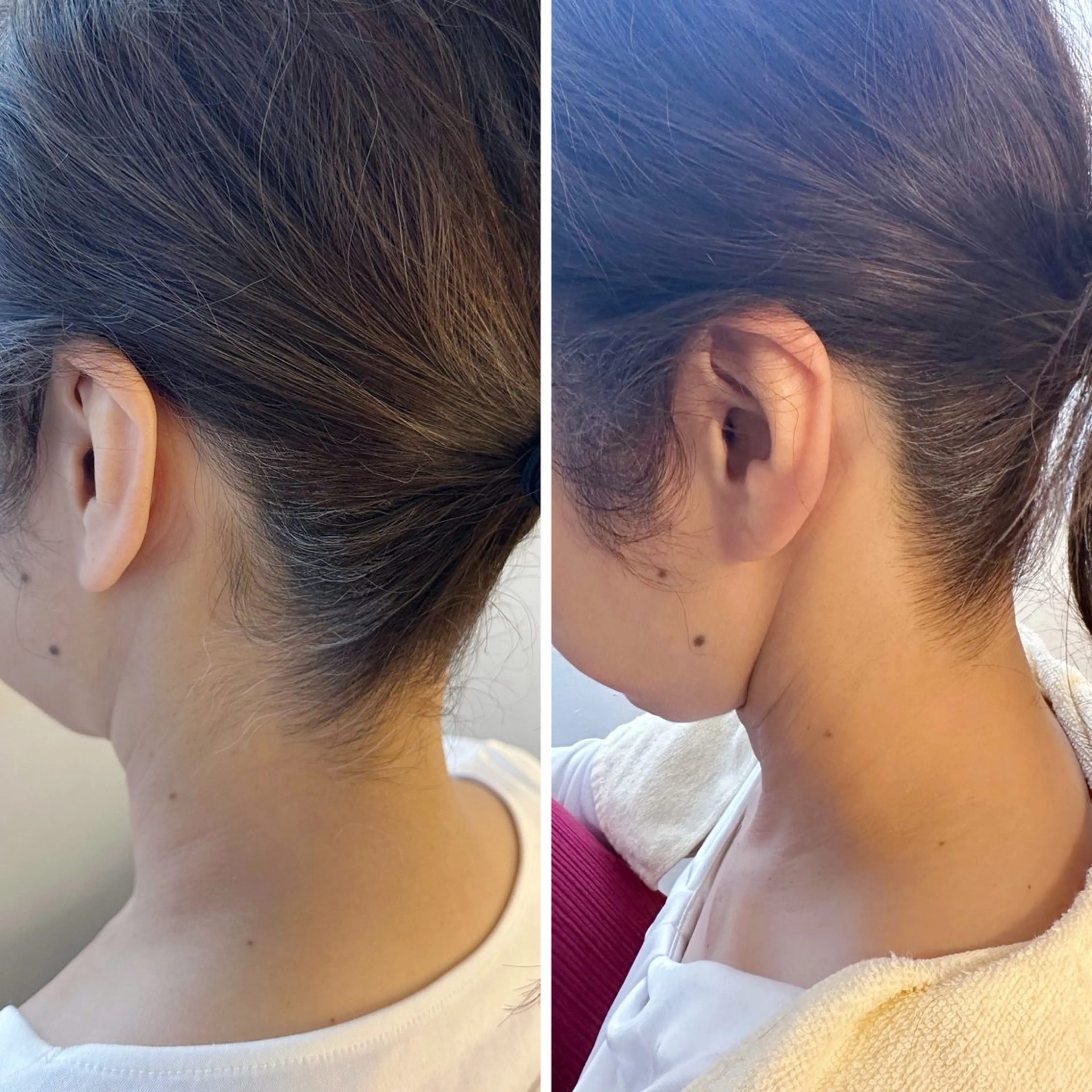 脱毛 うなじ脱毛/美肌脱毛 LABELのエステ・リラクイメージ