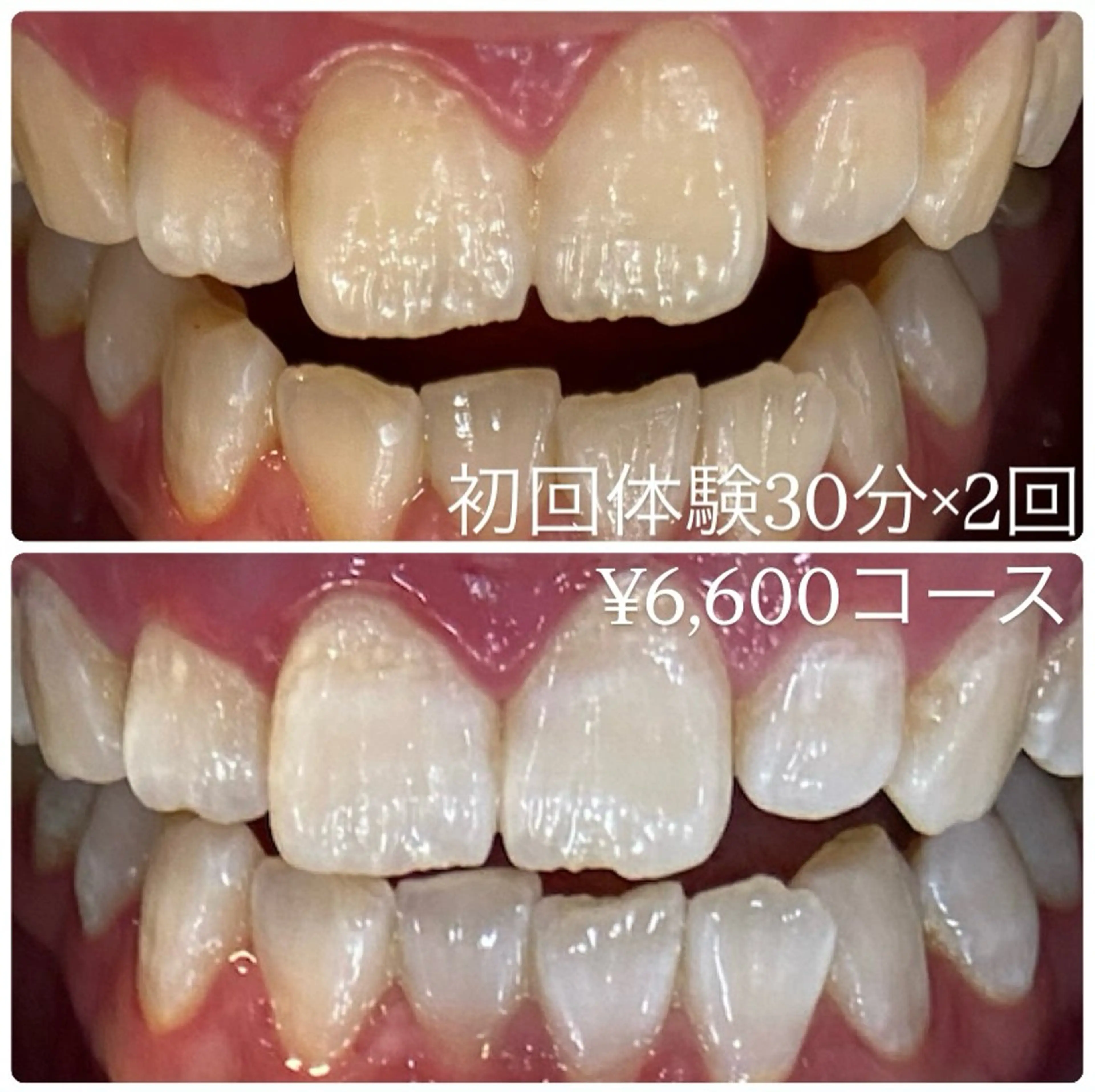 PLATINUM Beauty 横浜店所属・ホワイトニングルーム 横浜店のその他イメージ