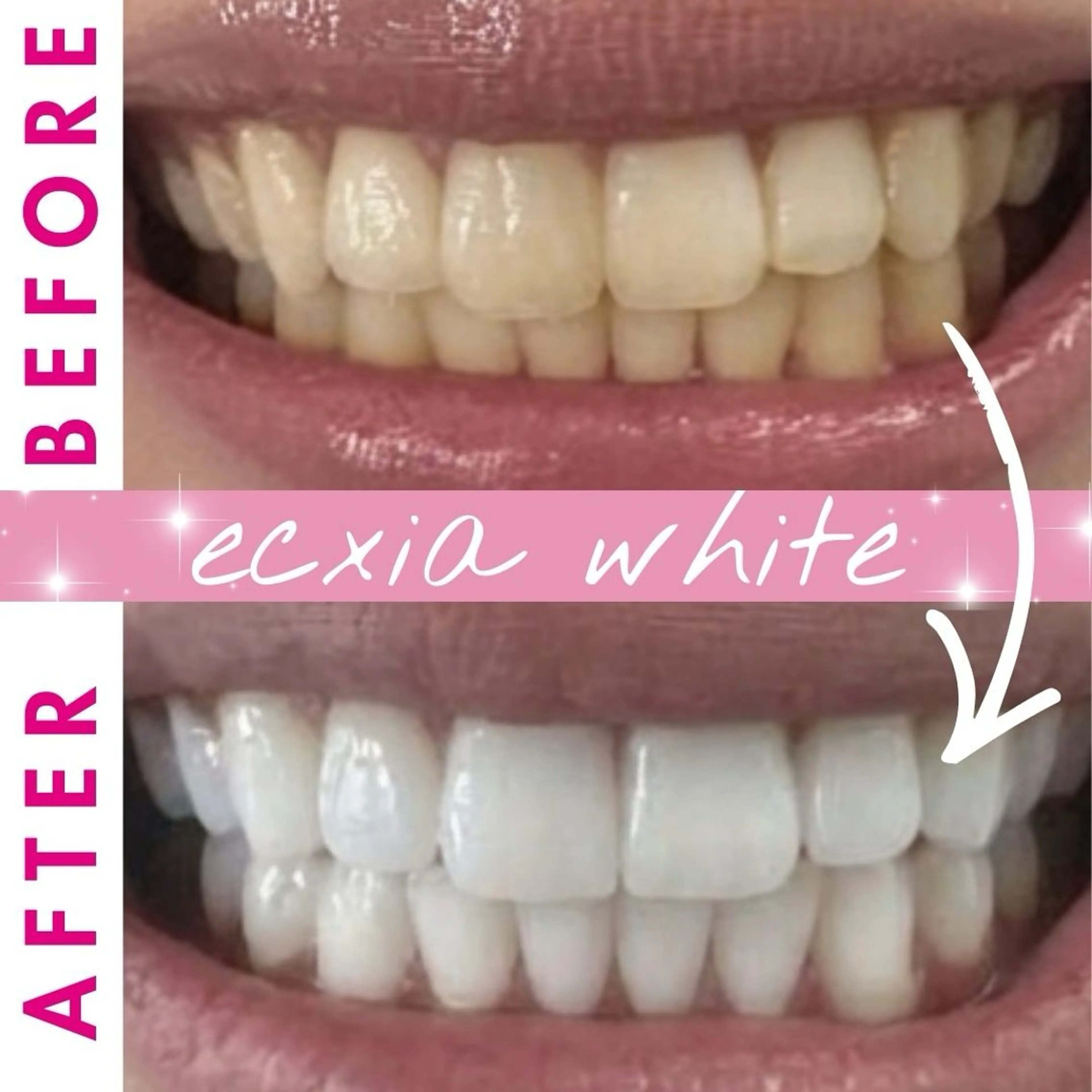 その他 セルフホワイトニングサロン　エクシアホワイト西尾店所属・エクシアホワイト西尾 堀内恵のその他イメージ