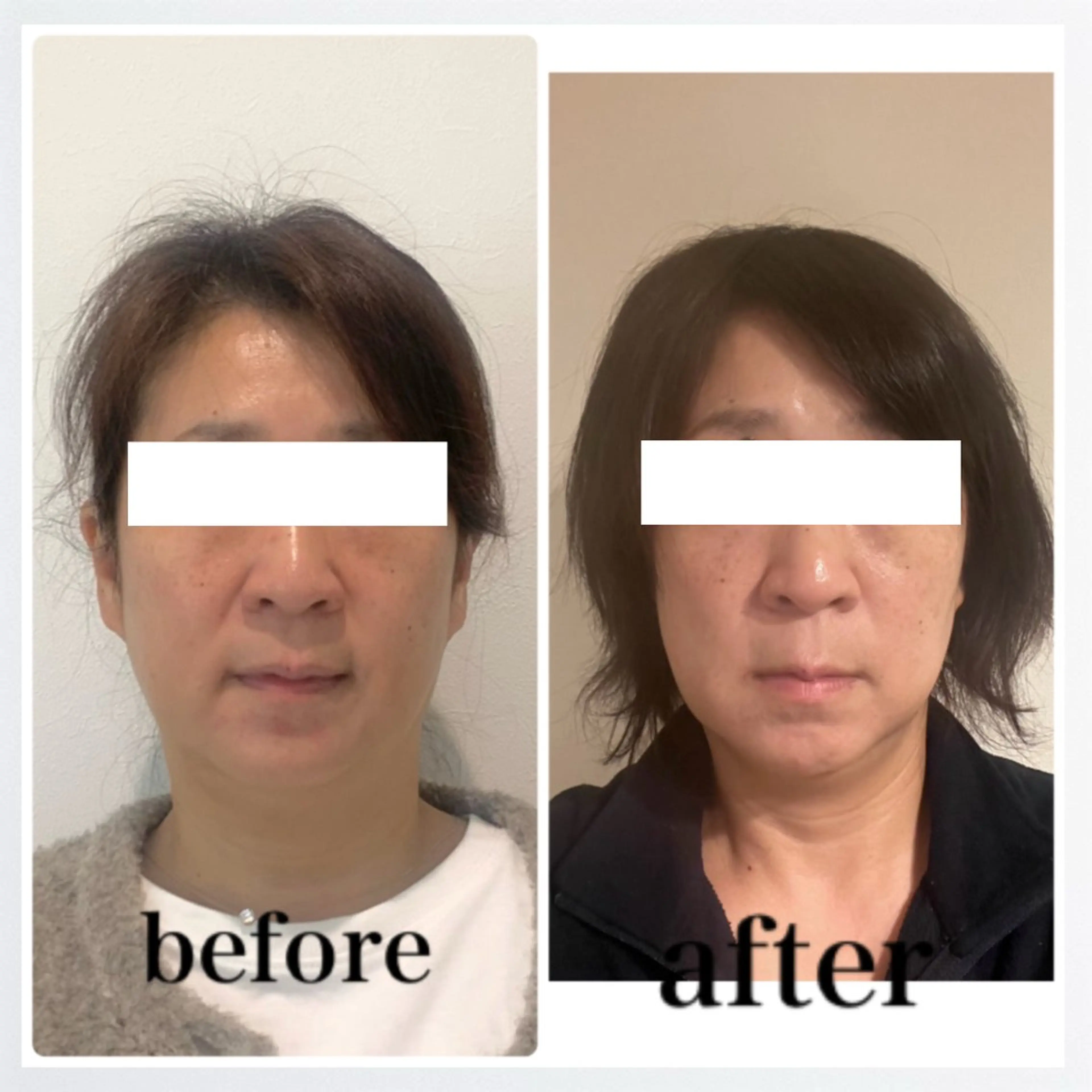 エステ リラク 小顔と ヘッドスパのお店のエステ・リラクイメージ