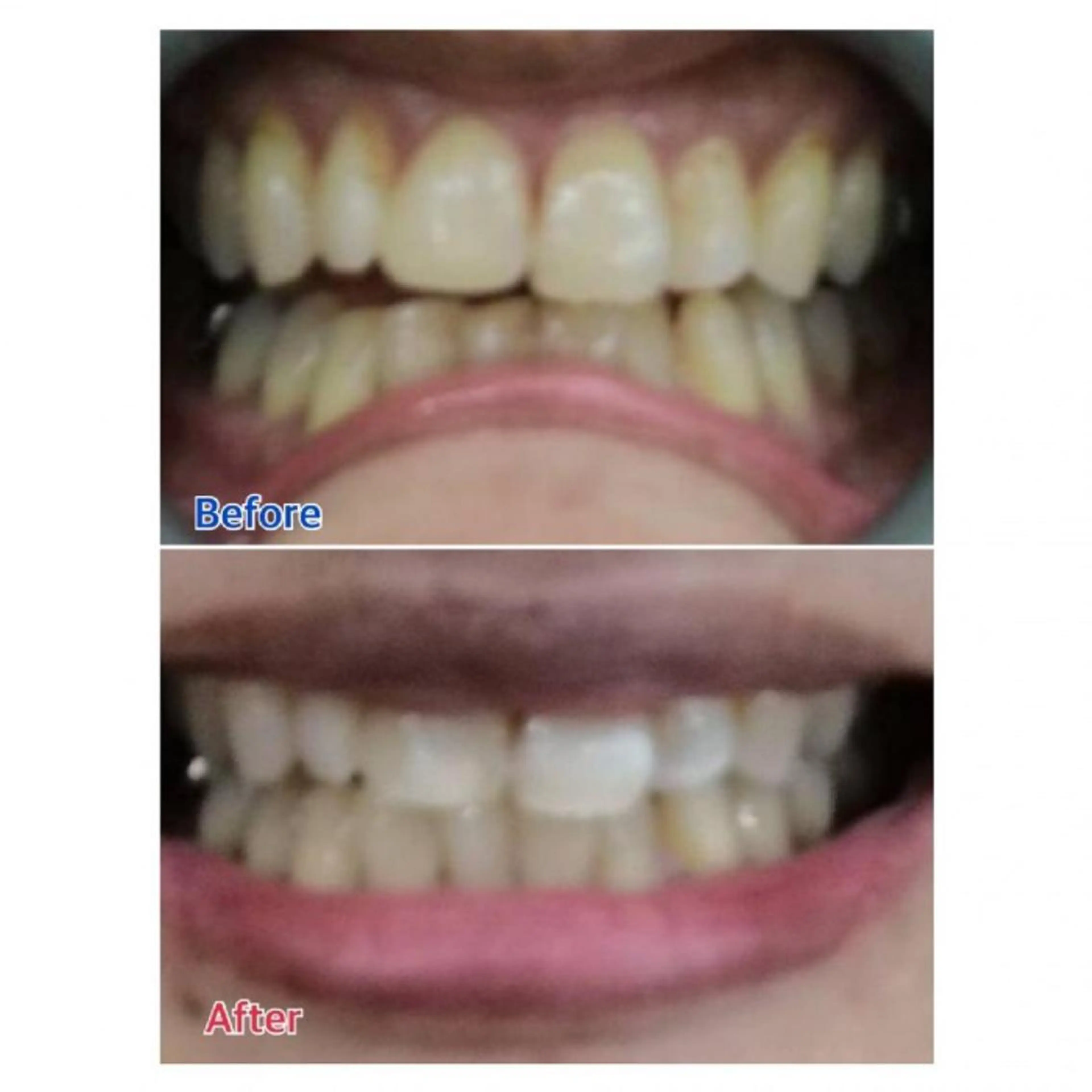 M渋谷店所属・Ｍ渋谷 ホワイトニングのその他イメージ