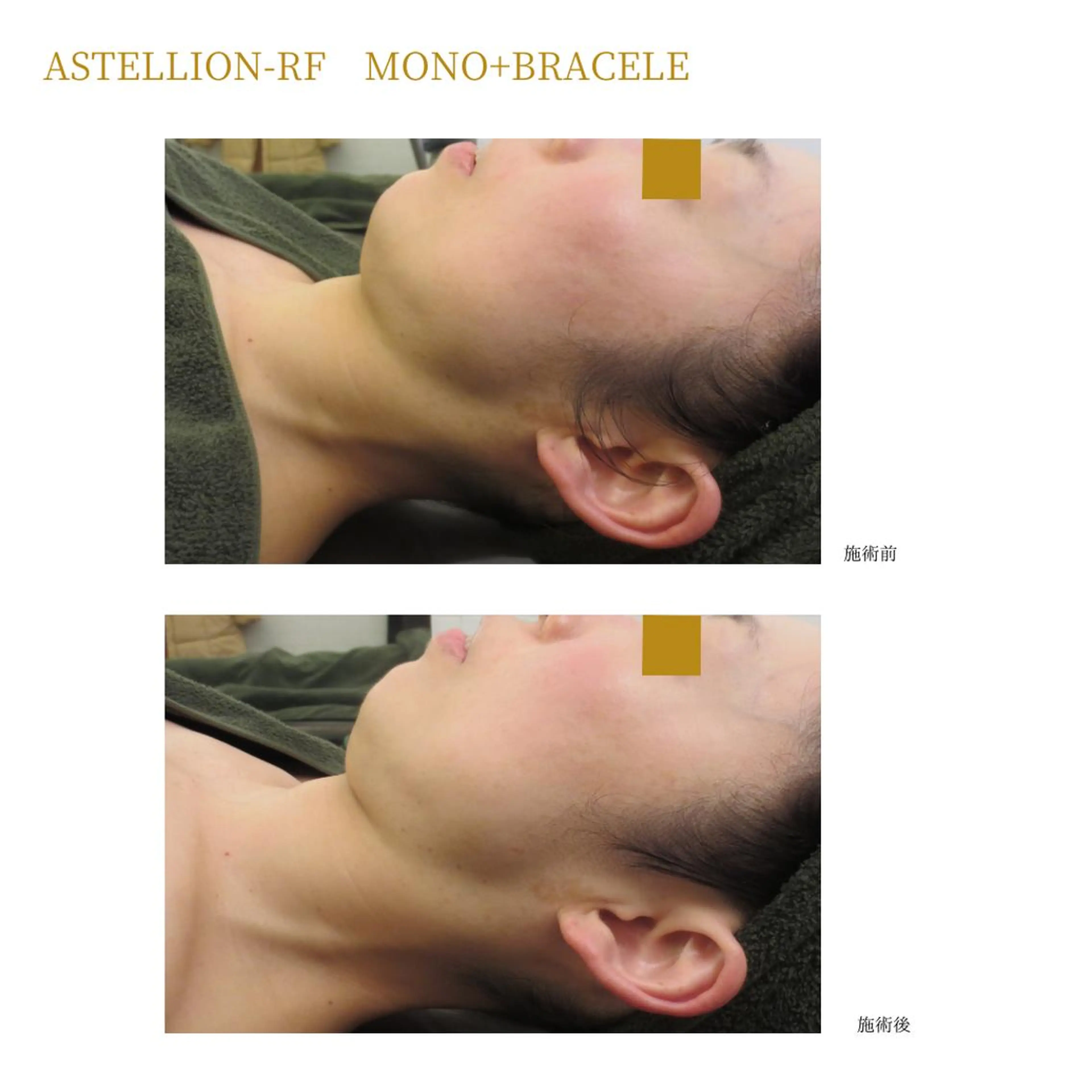 Sylphya (シルフィア)のエステ・リラクイメージ