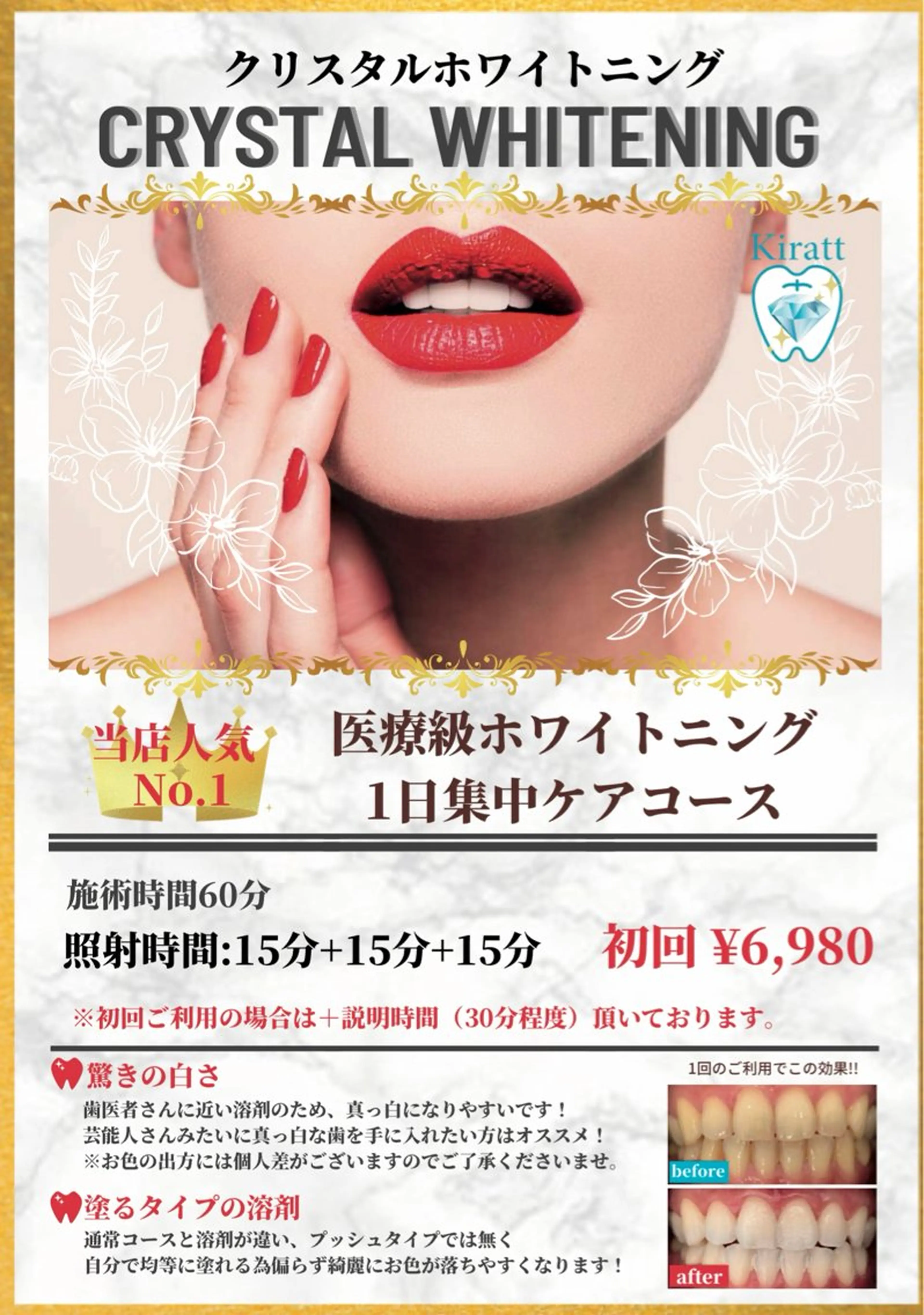 セルフホワイトニングサロンKiratt札幌店💎所属・Kiratt 札幌店のその他イメージ