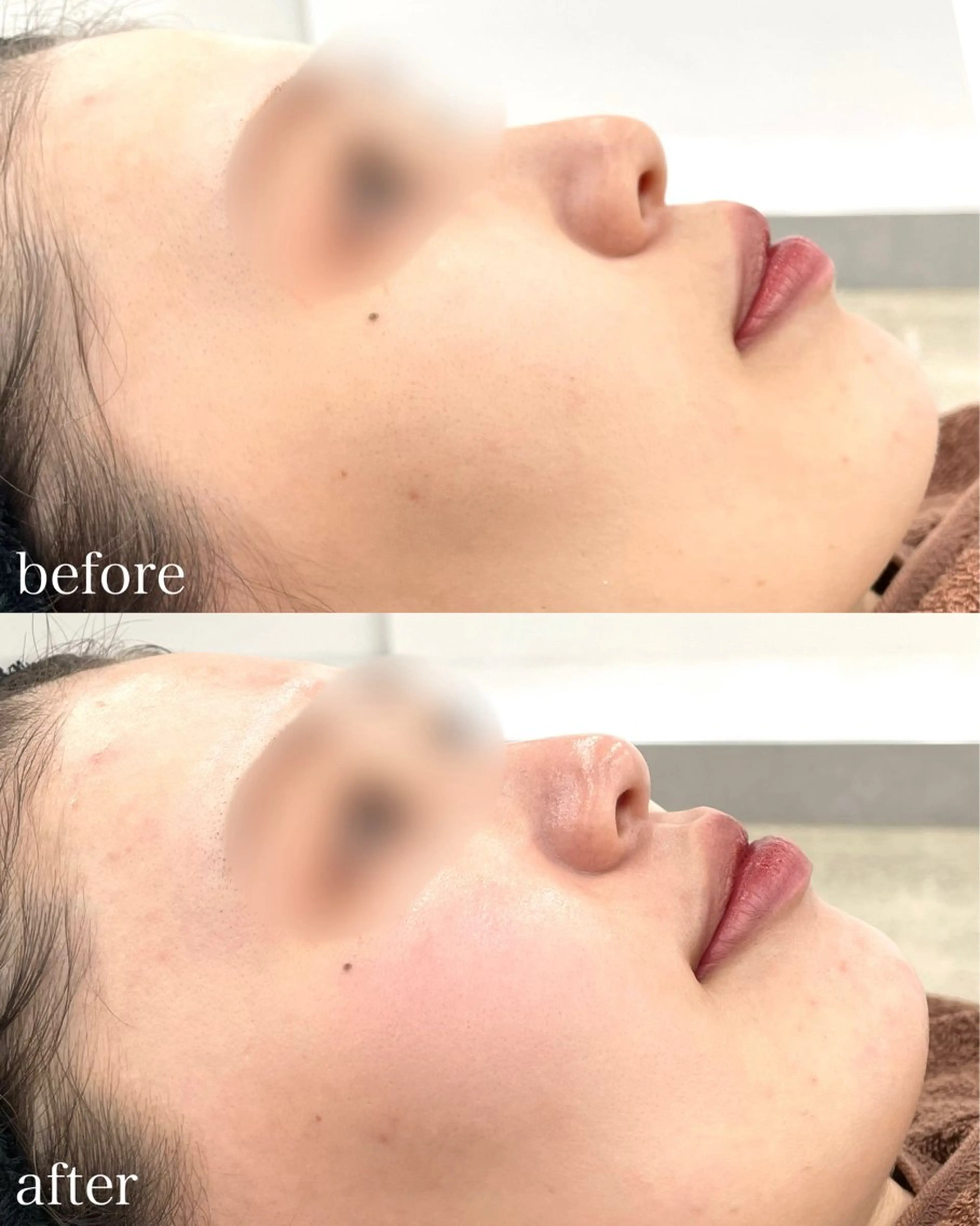 脱毛 Beauty produce salon わたしいろ所属・パーソナルカラー/ メイクレッスン/みきのその他イメージ