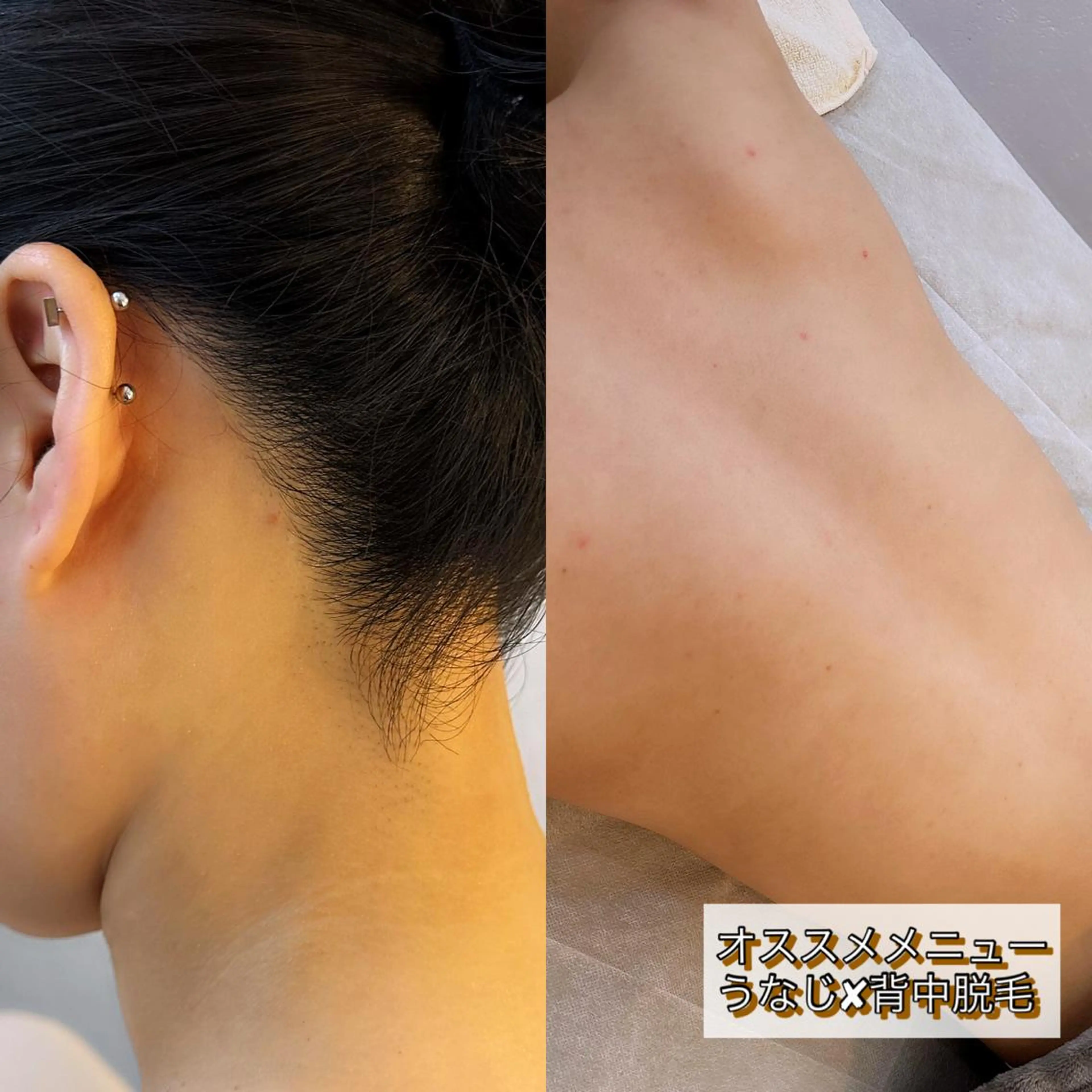 うなじ脱毛/美肌脱毛 LABELのエステ・リラクイメージ