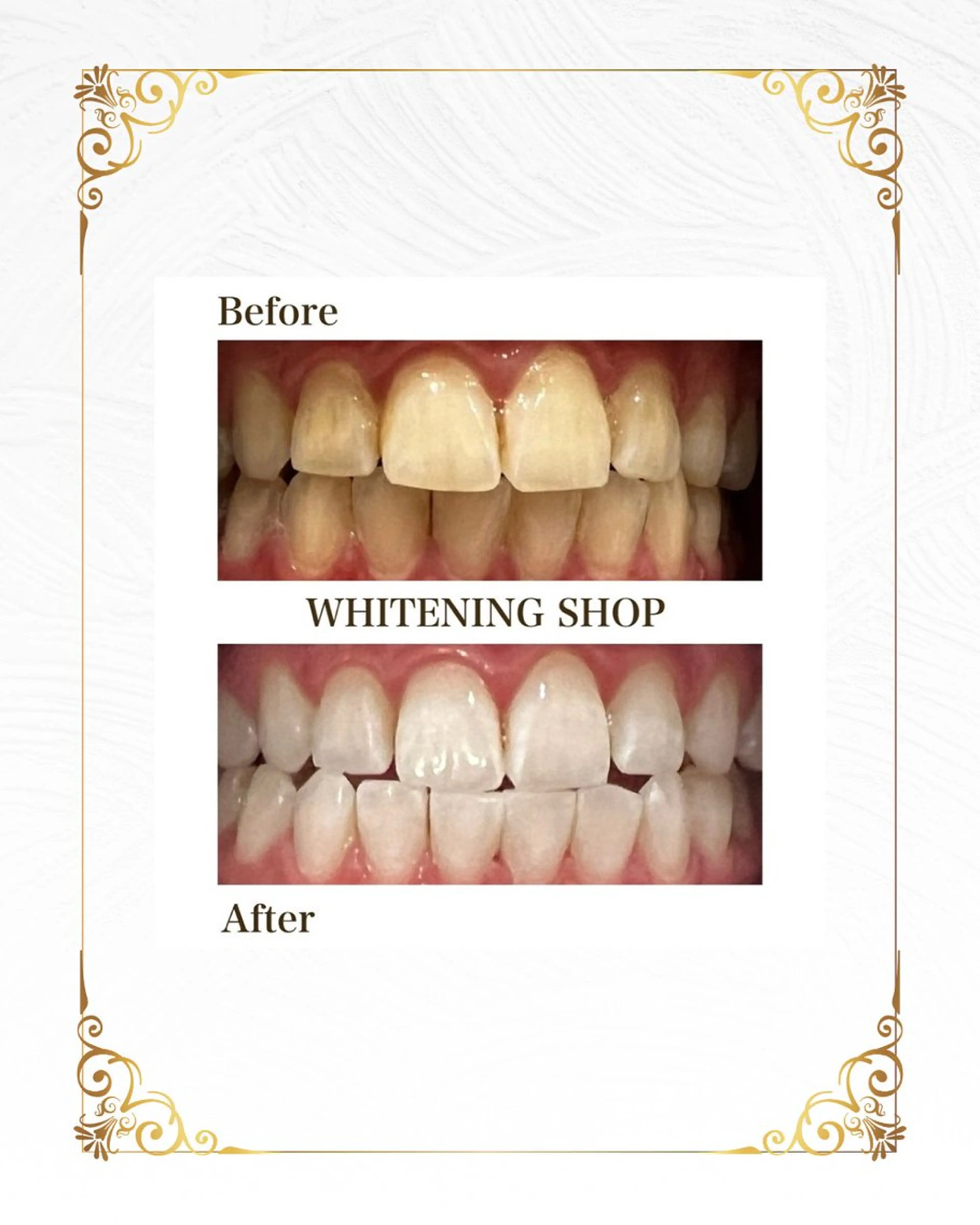 ホワイトニングショップ静岡葵区店所属・ホワイトニング ショップ葵区静岡駅店のその他イメージ