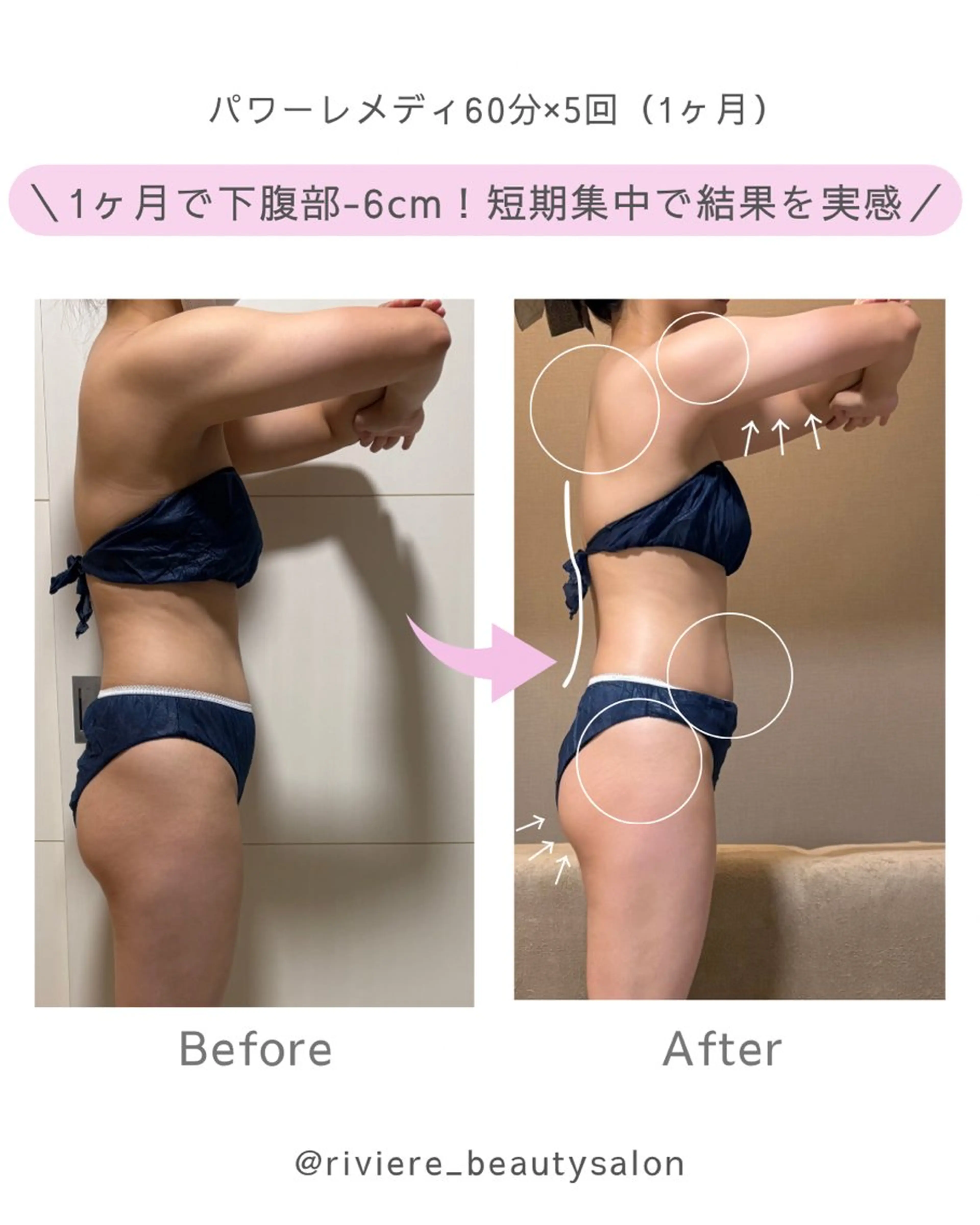 その他 Riviere所属・＼痩身×不調ケア／ Riviereのエステ・リラクイメージ