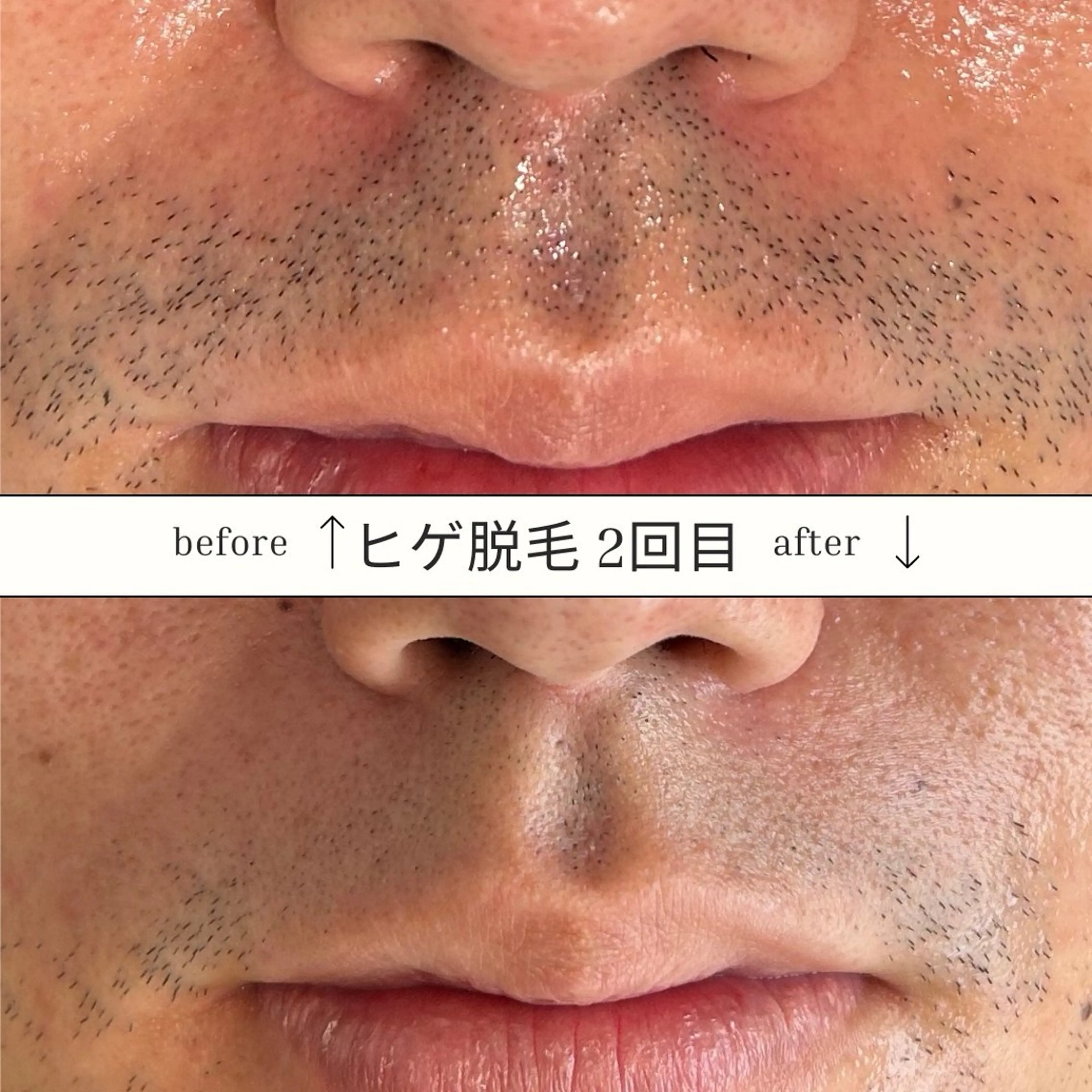 メンズ 脱毛 SKIN GYM所属・SKIN GYM メンズ専門脱毛サロンのエステ・リラクイメージ