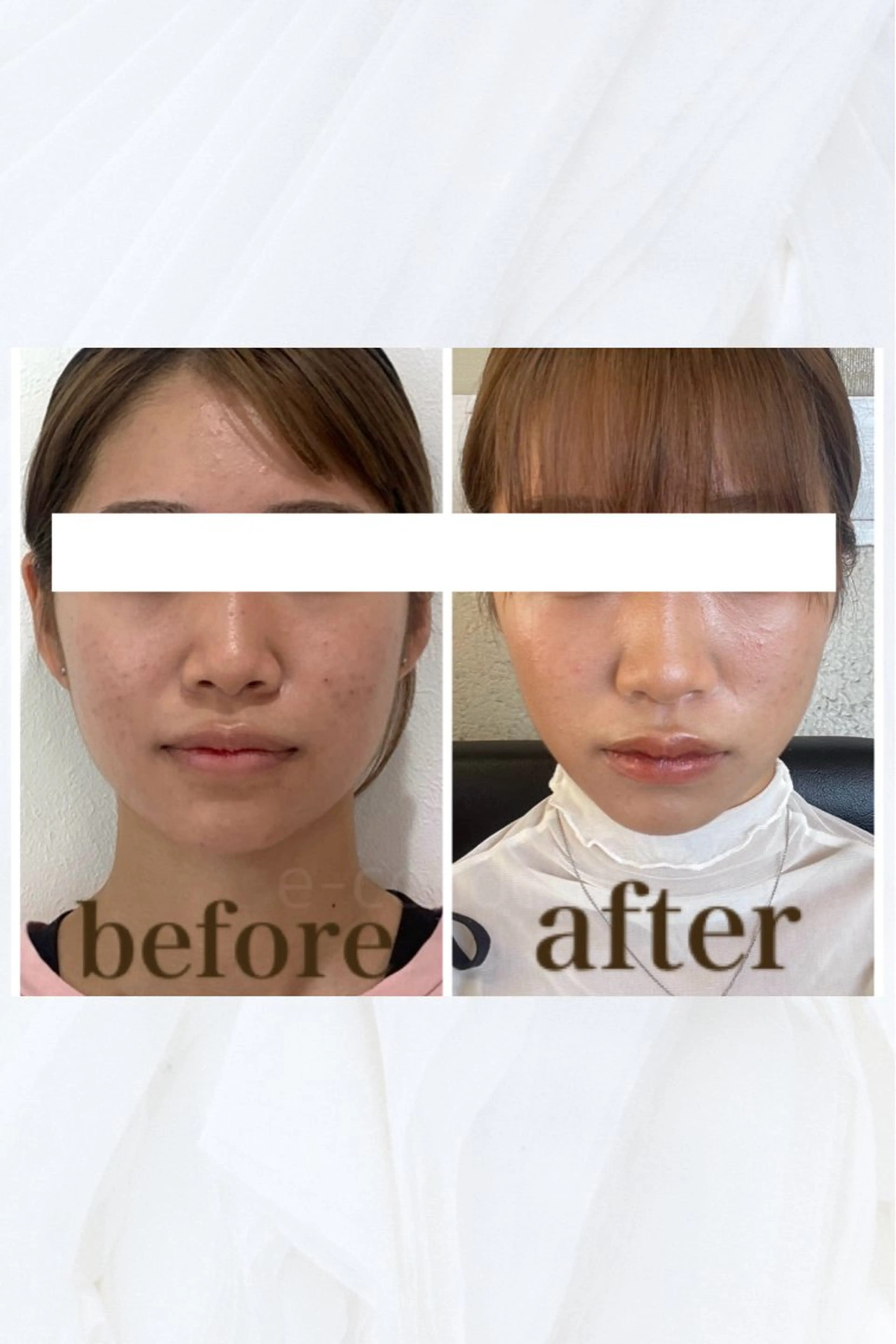 エステ リラク 小顔と ヘッドスパのお店のエステ・リラクイメージ