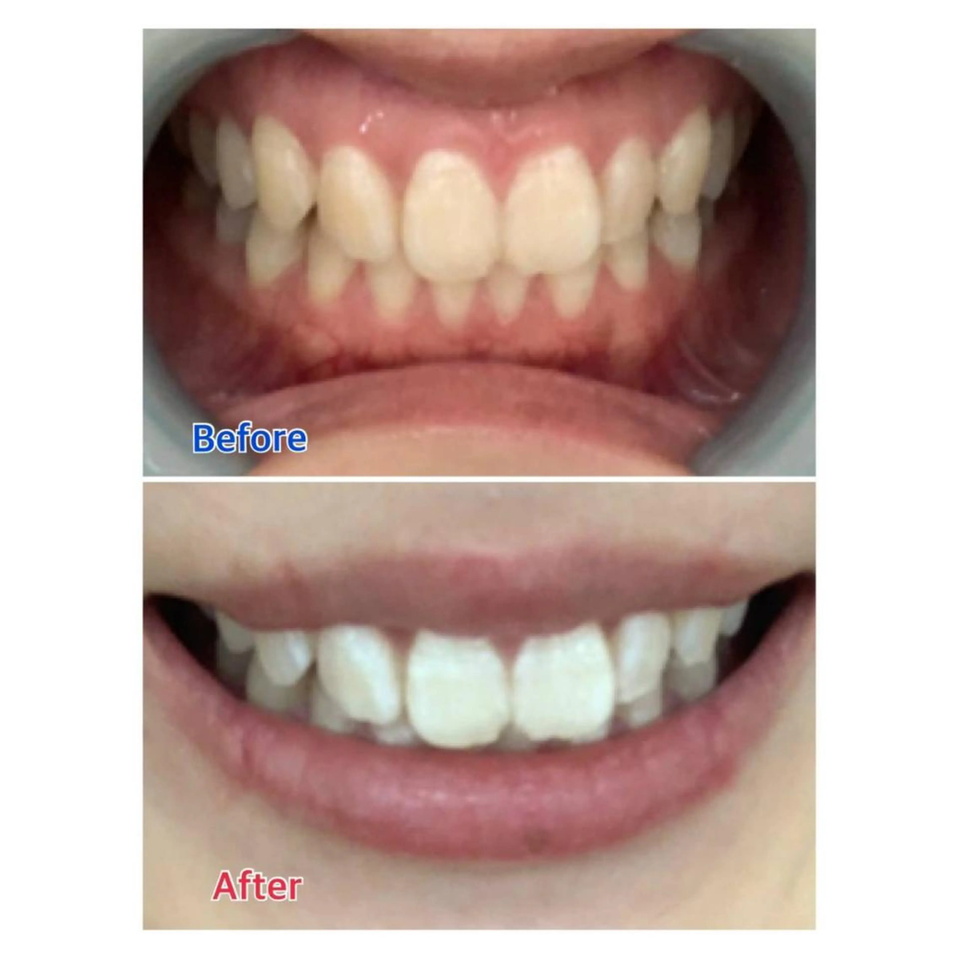 MBEAUTYSALON 千葉店・京成大久保所属・Melty 輝のその他イメージ