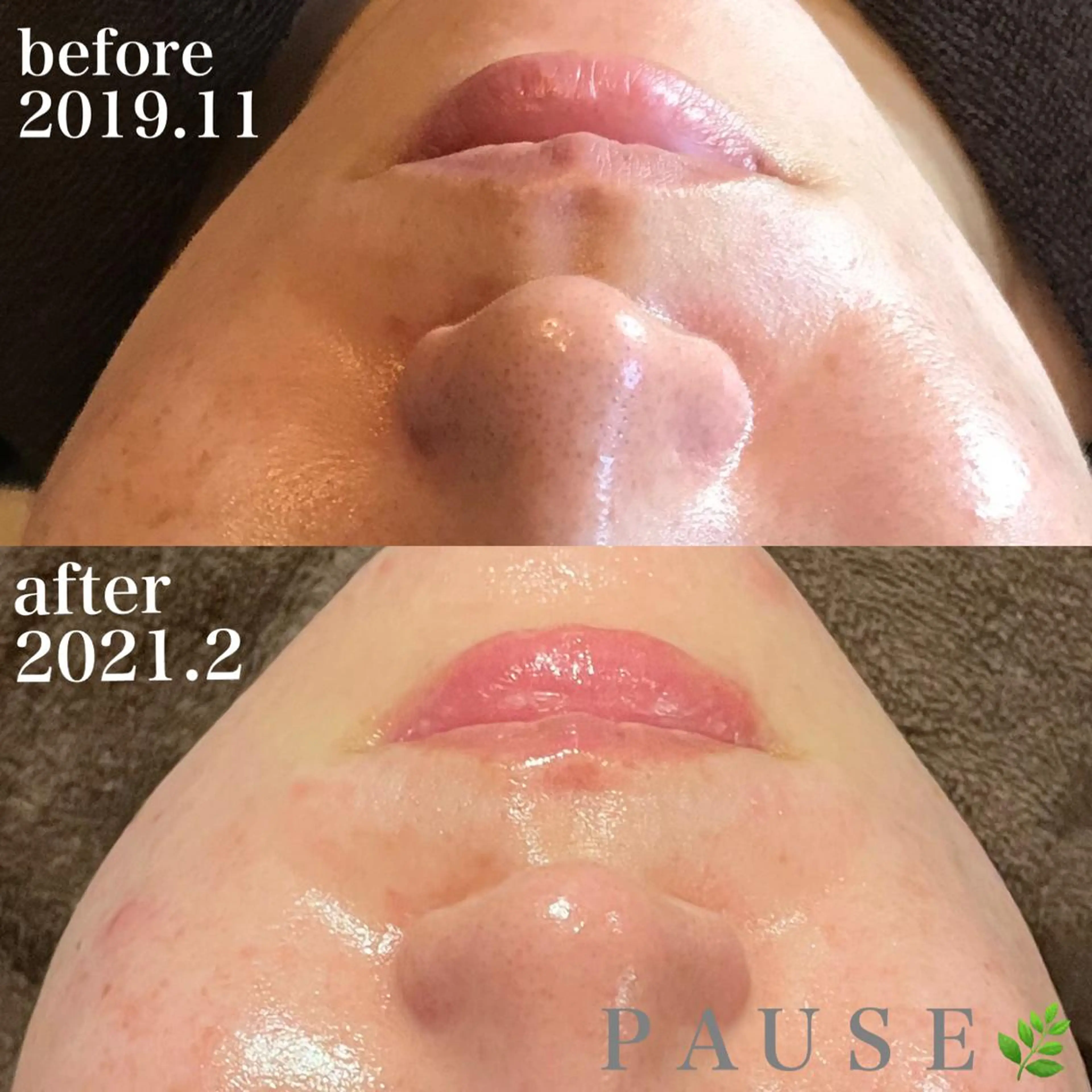 エステ 浜野 恵美のエステ・リラクイメージ