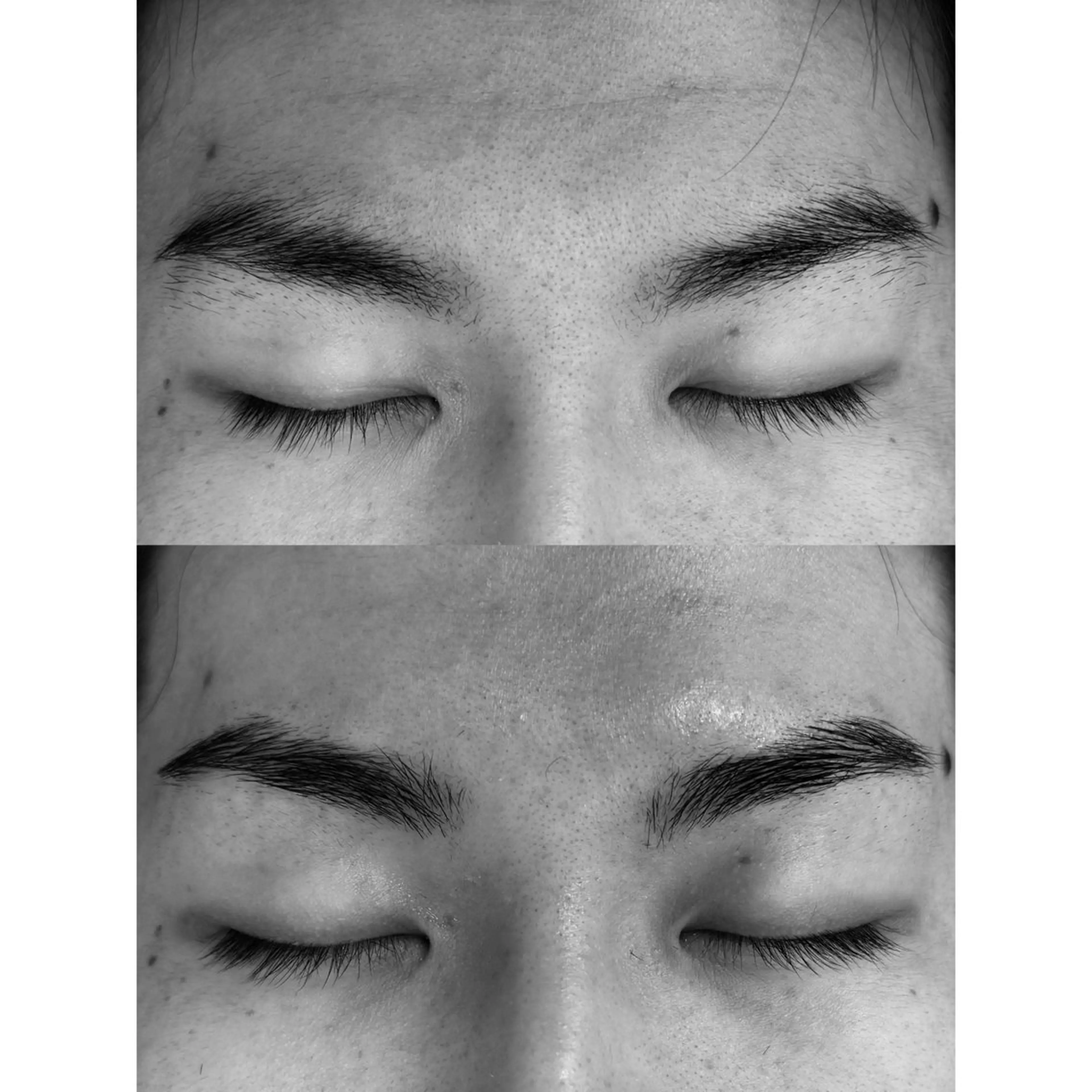 メンズブロウリフトの写真