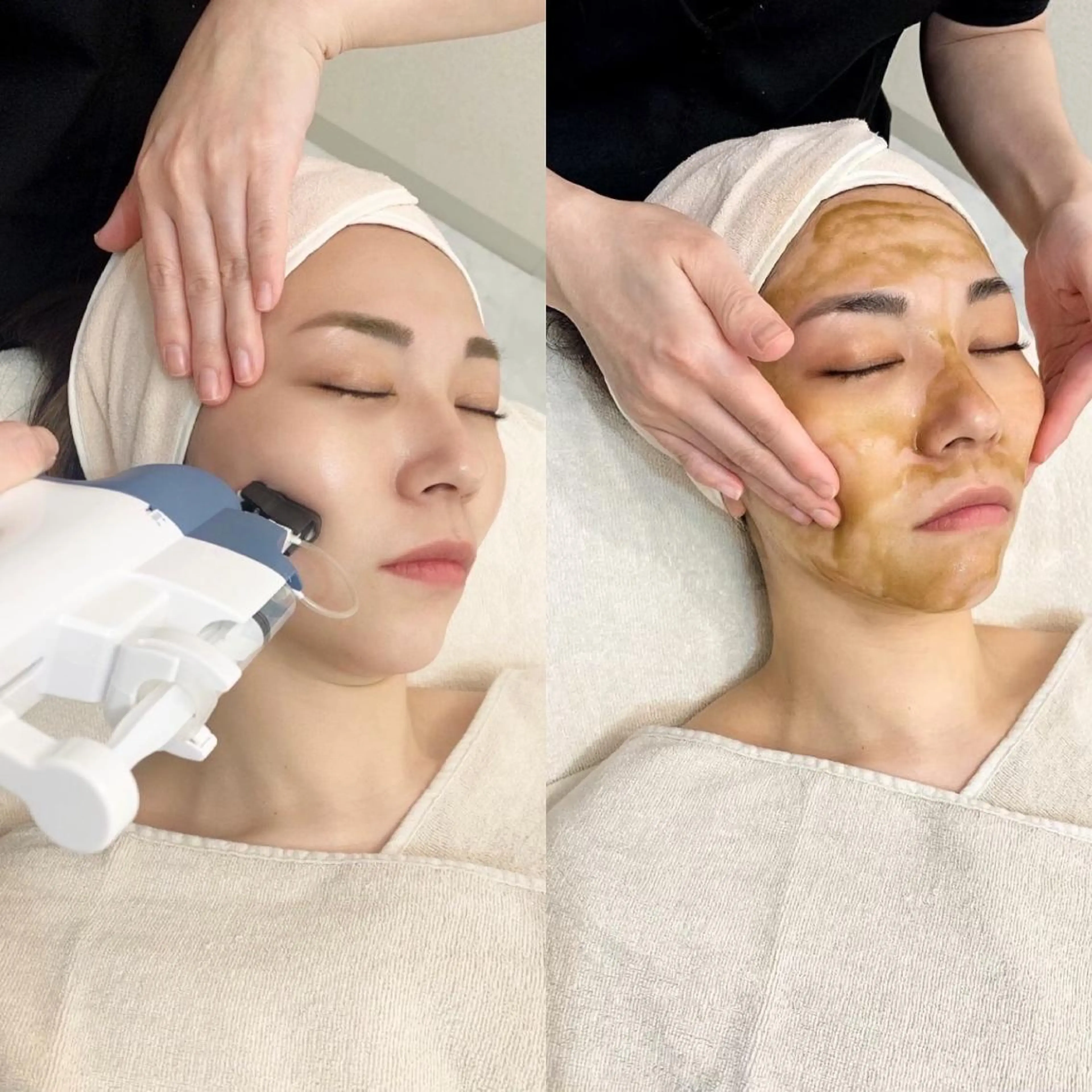 エステ ✨美肌水光✨ アトリエリュバンのエステ・リラクイメージ