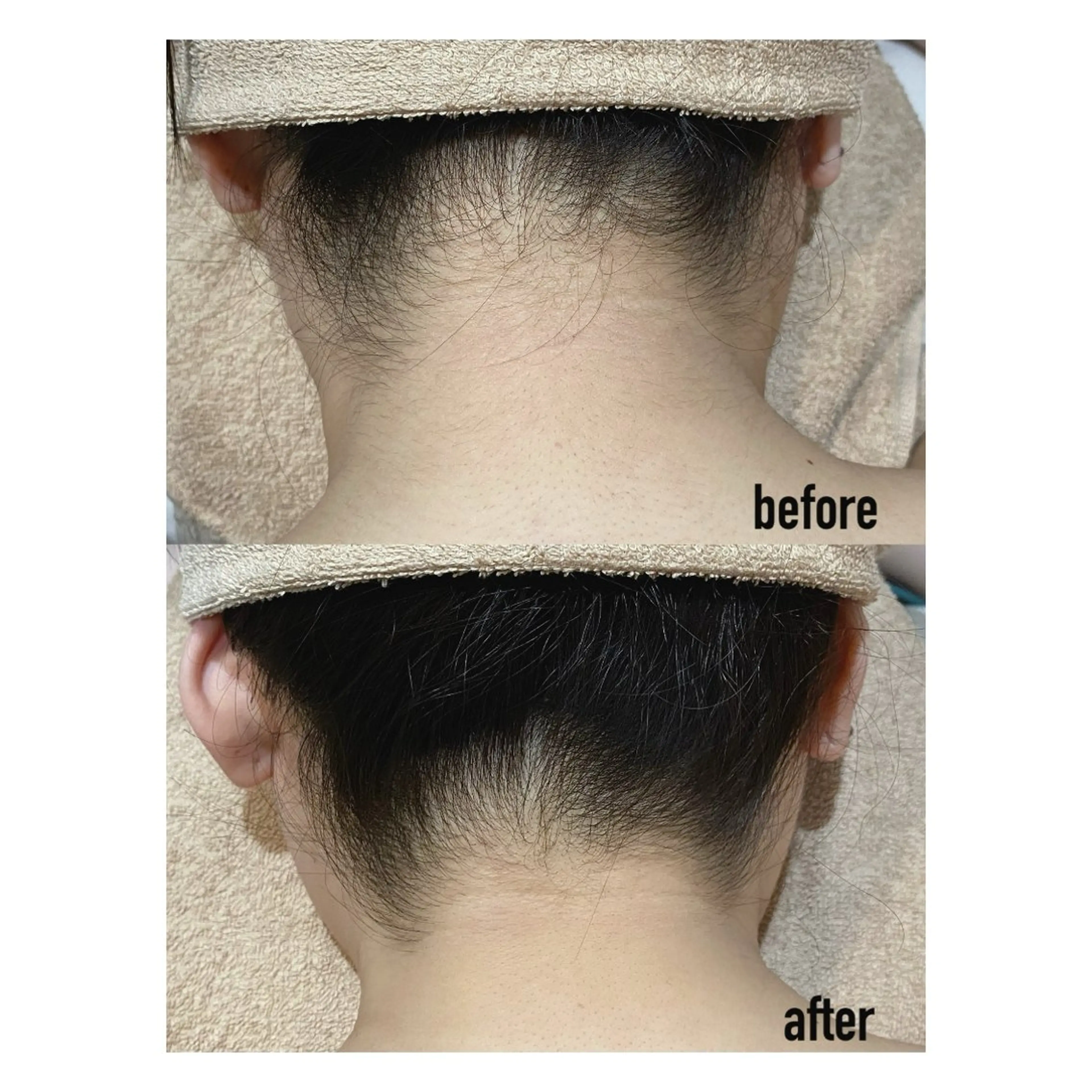 脱毛 M's Style NAIL BARのエステ・リラクイメージ