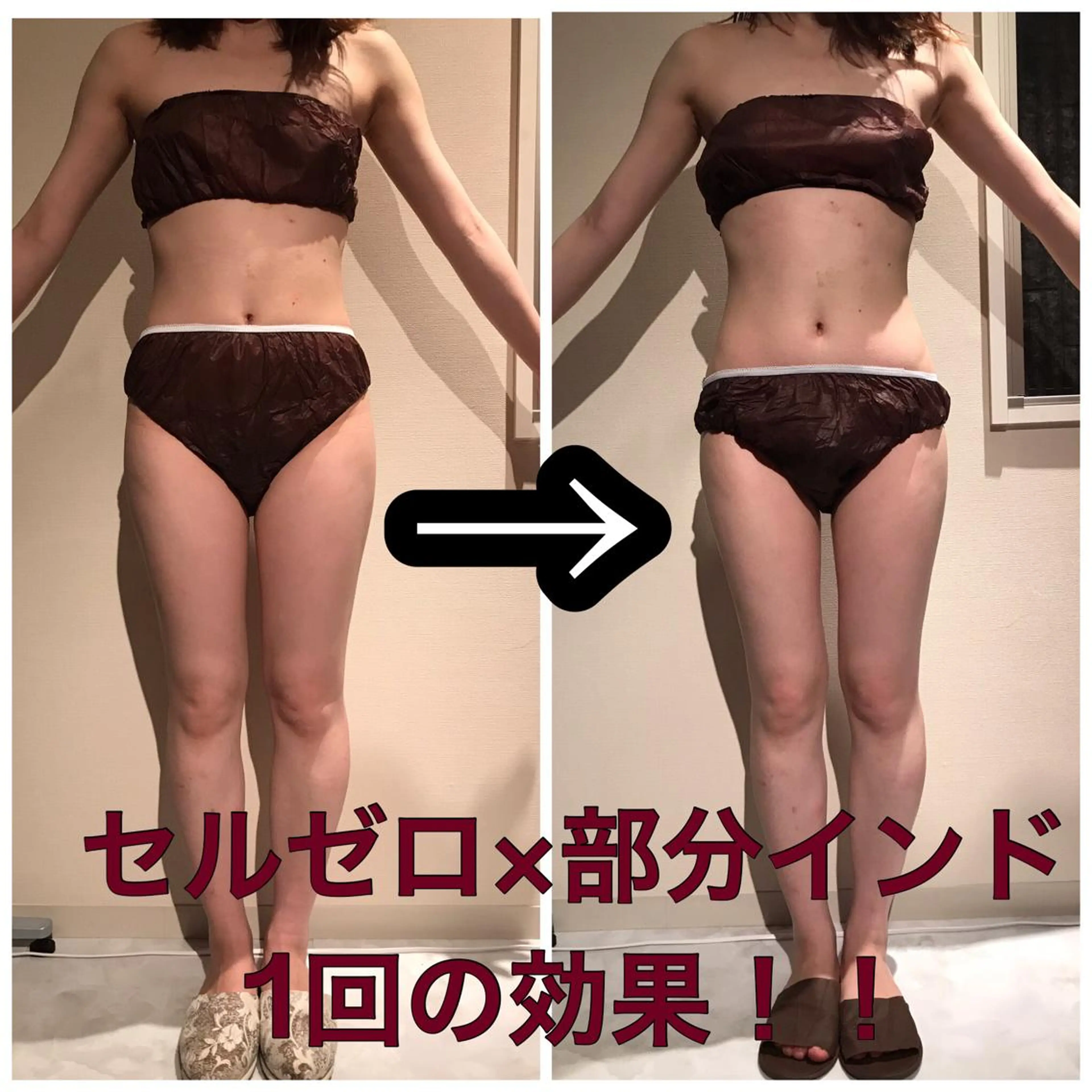 Cielo(シエロ) ダイエット専門店のエステ・リラクイメージ