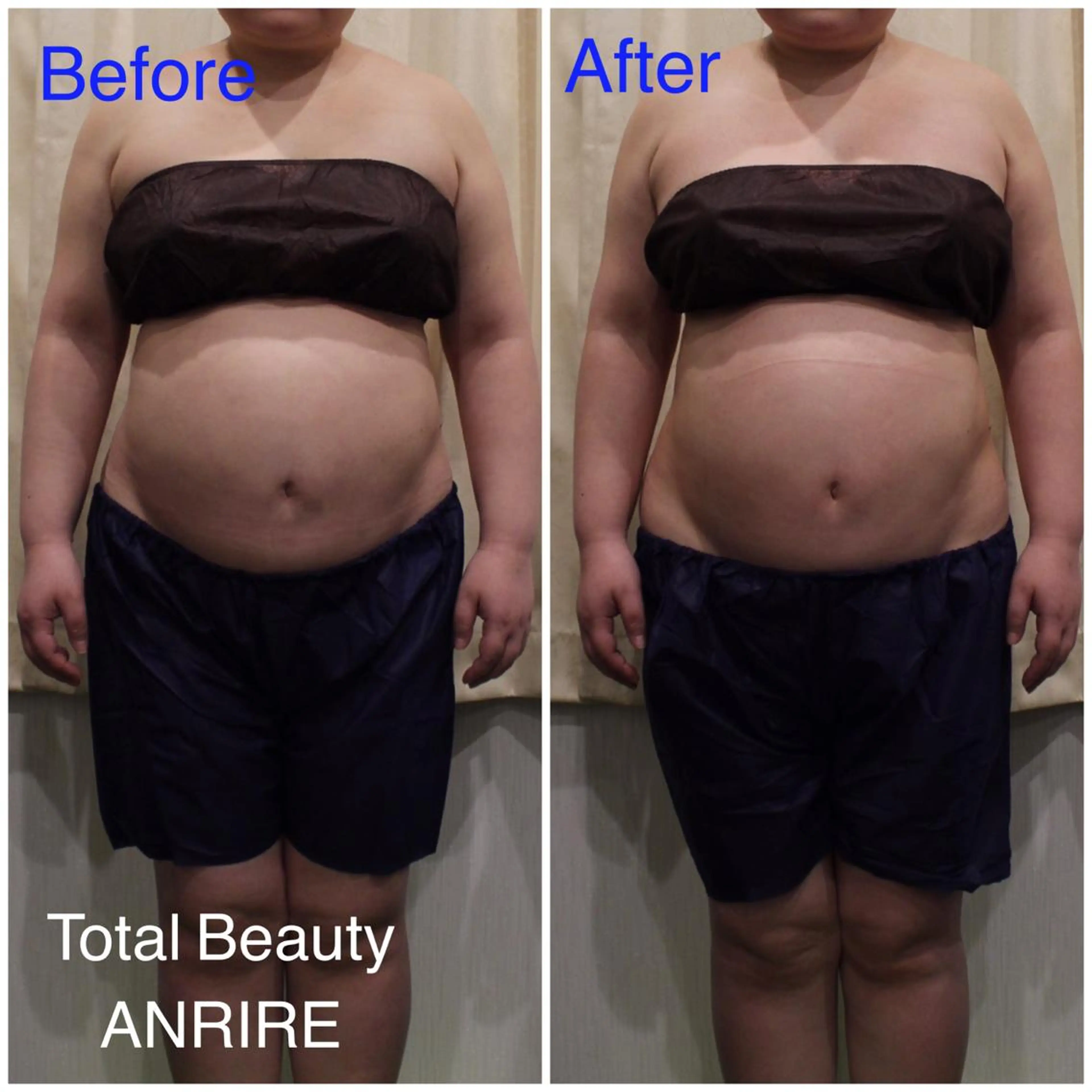 ANRIRE (アンリール)のエステ・リラクイメージ