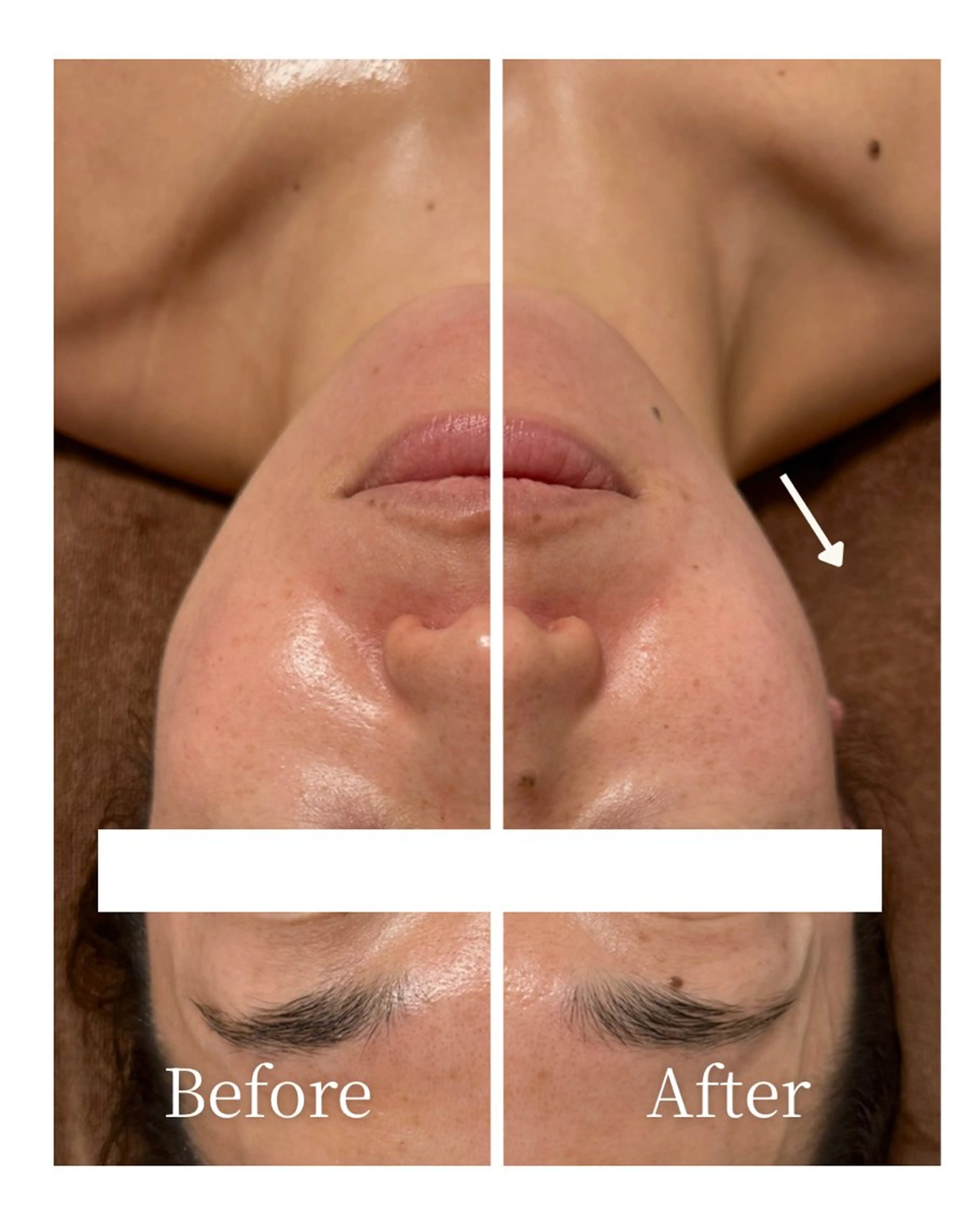 Lani Moon所属・⟡ 京都 小顔  ⊹ Lani Moonのエステ・リラクイメージ