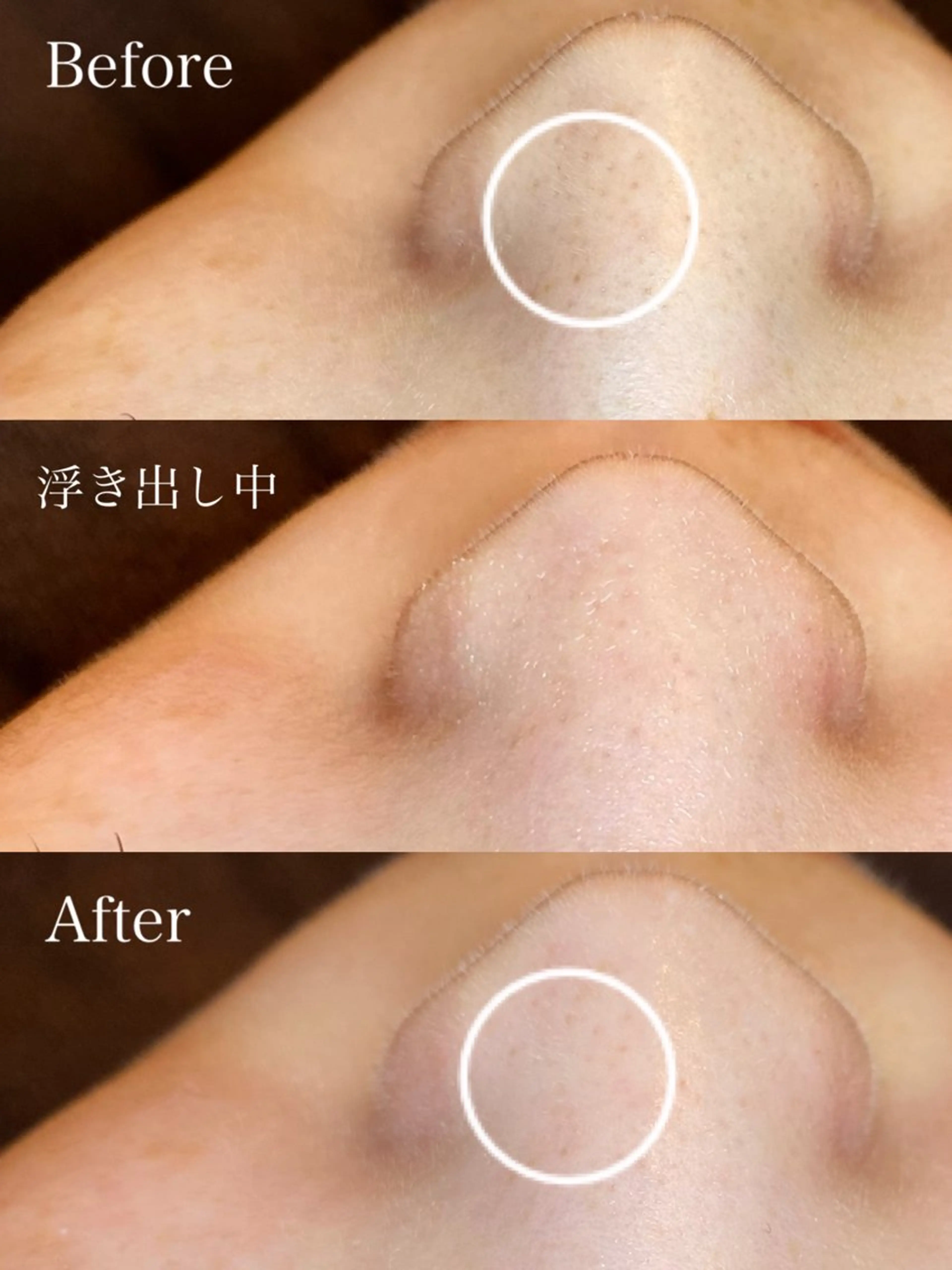 EARTH coiffure beaute 新潟紫竹山店所属・🤍アベシュリ /フェイシャル🤍のエステ・リラクイメージ