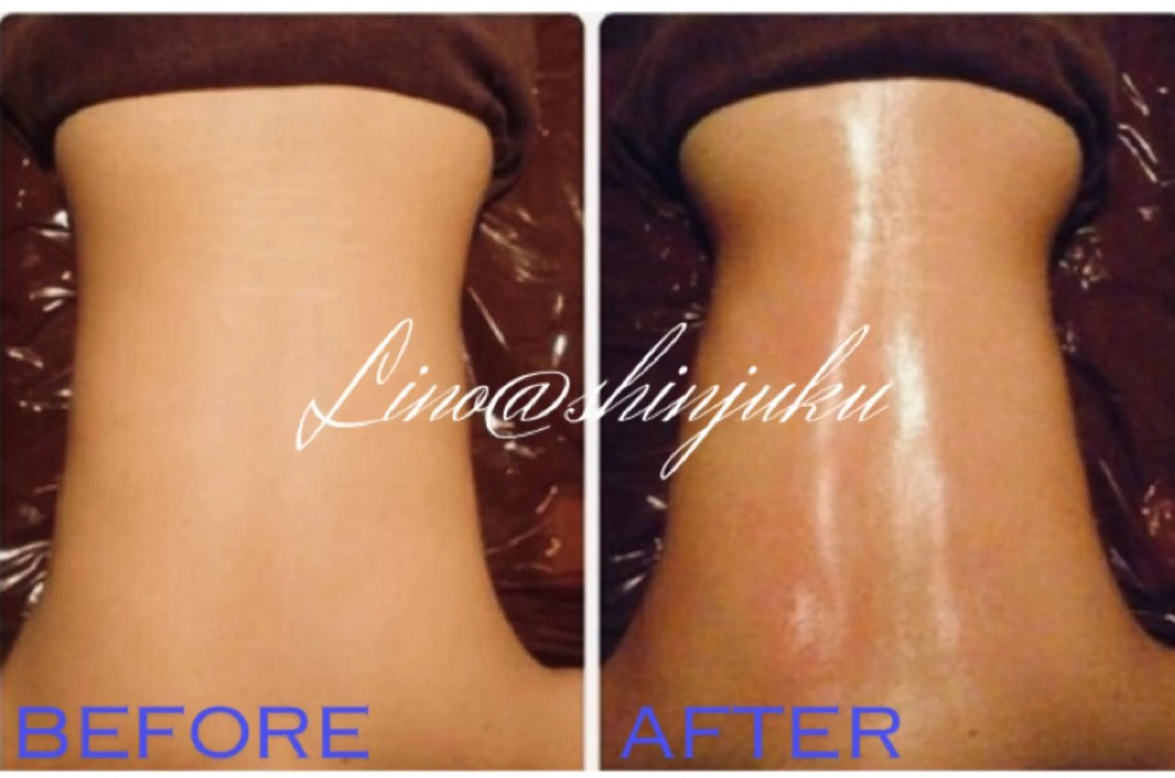 リラクゼーション ルナのエステ・リラクイメージ