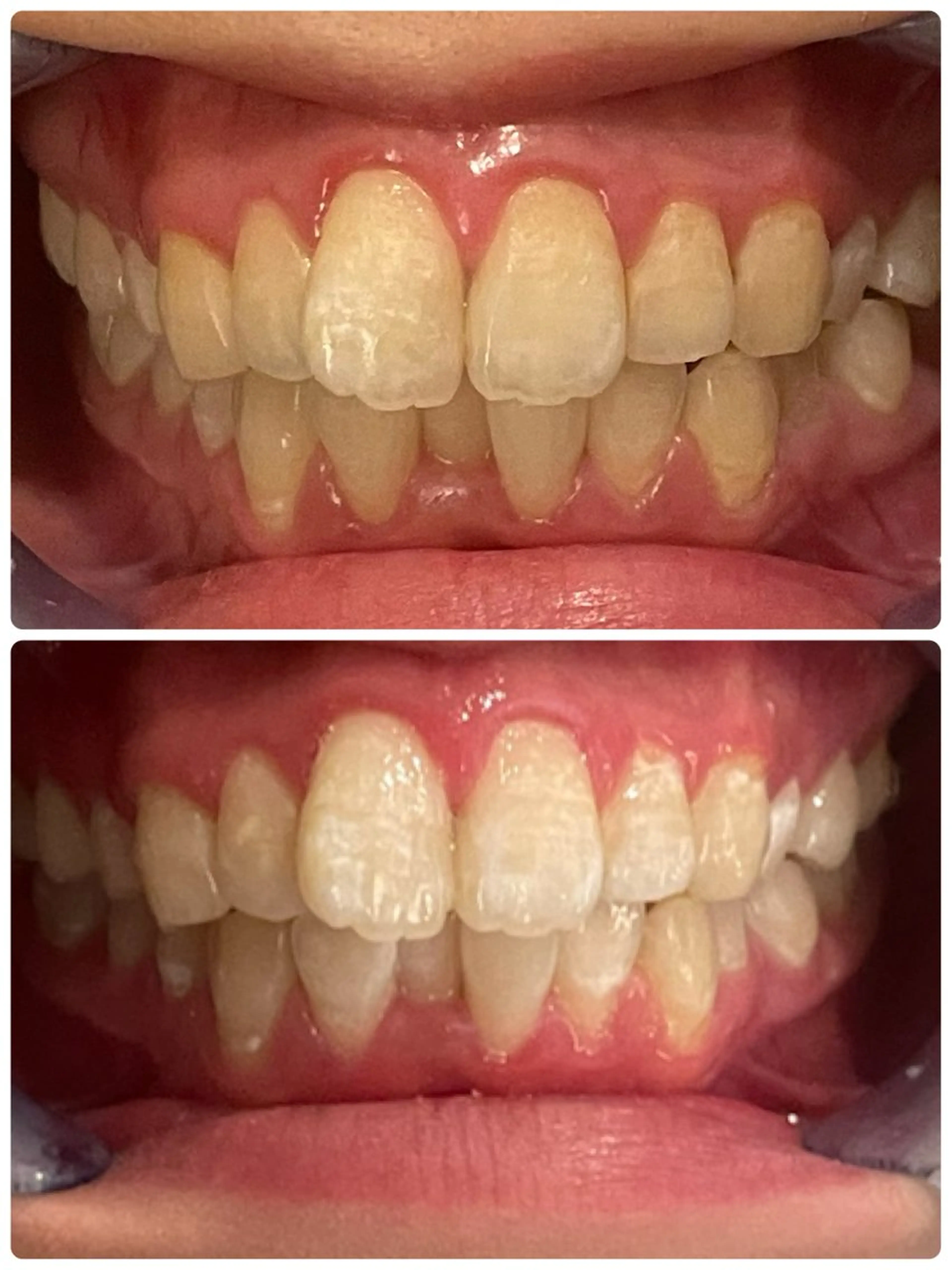 Monreve所属・美人スイッチdiet スーパージェクションのその他イメージ