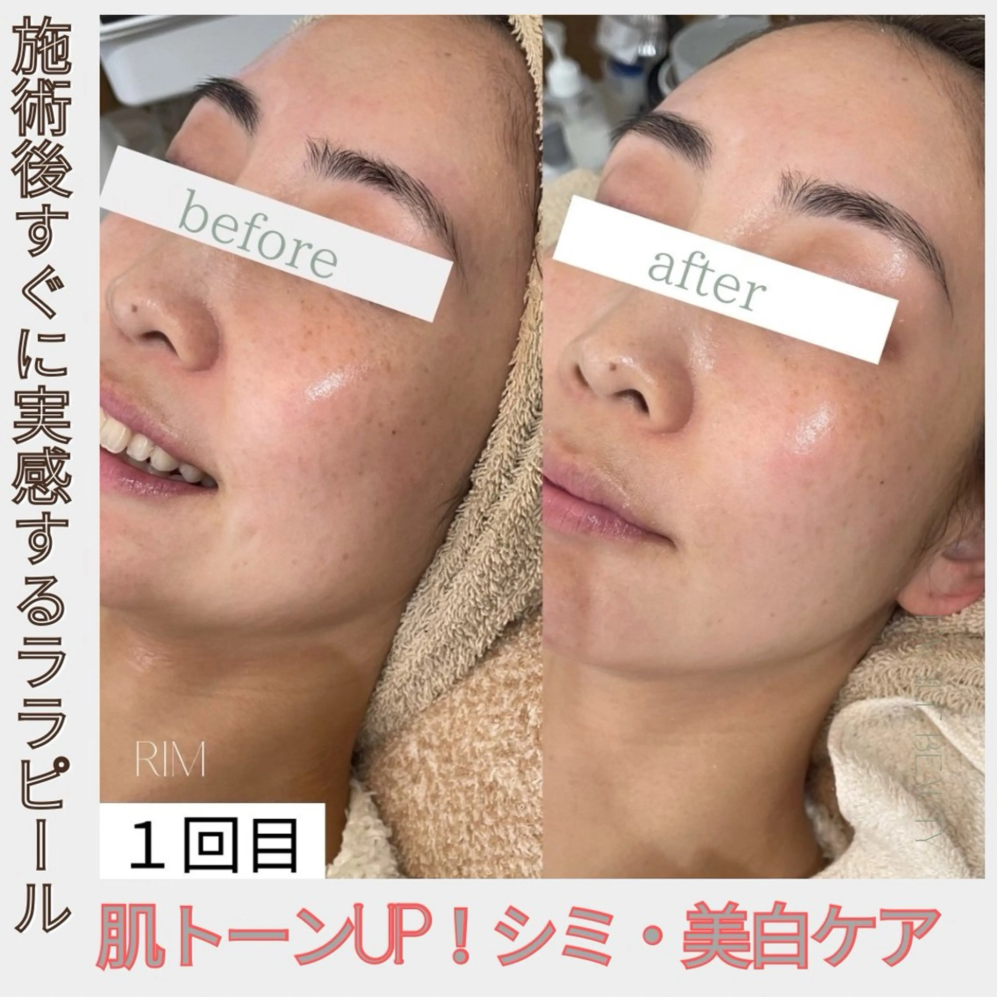 RIM total beautyのネイルデザイン