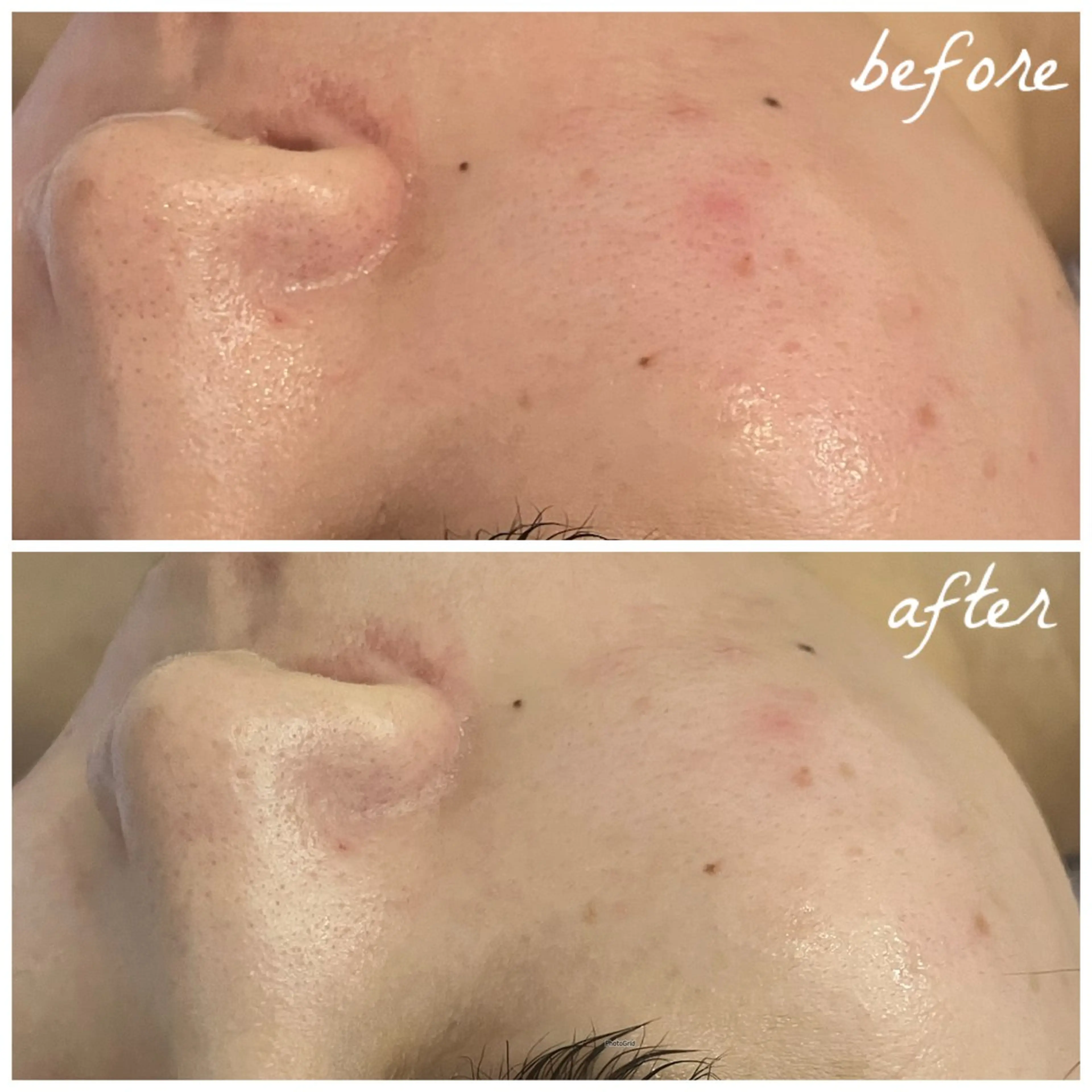 メンズ エステ メナード岐阜茜部 杉浦のエステ・リラクイメージ