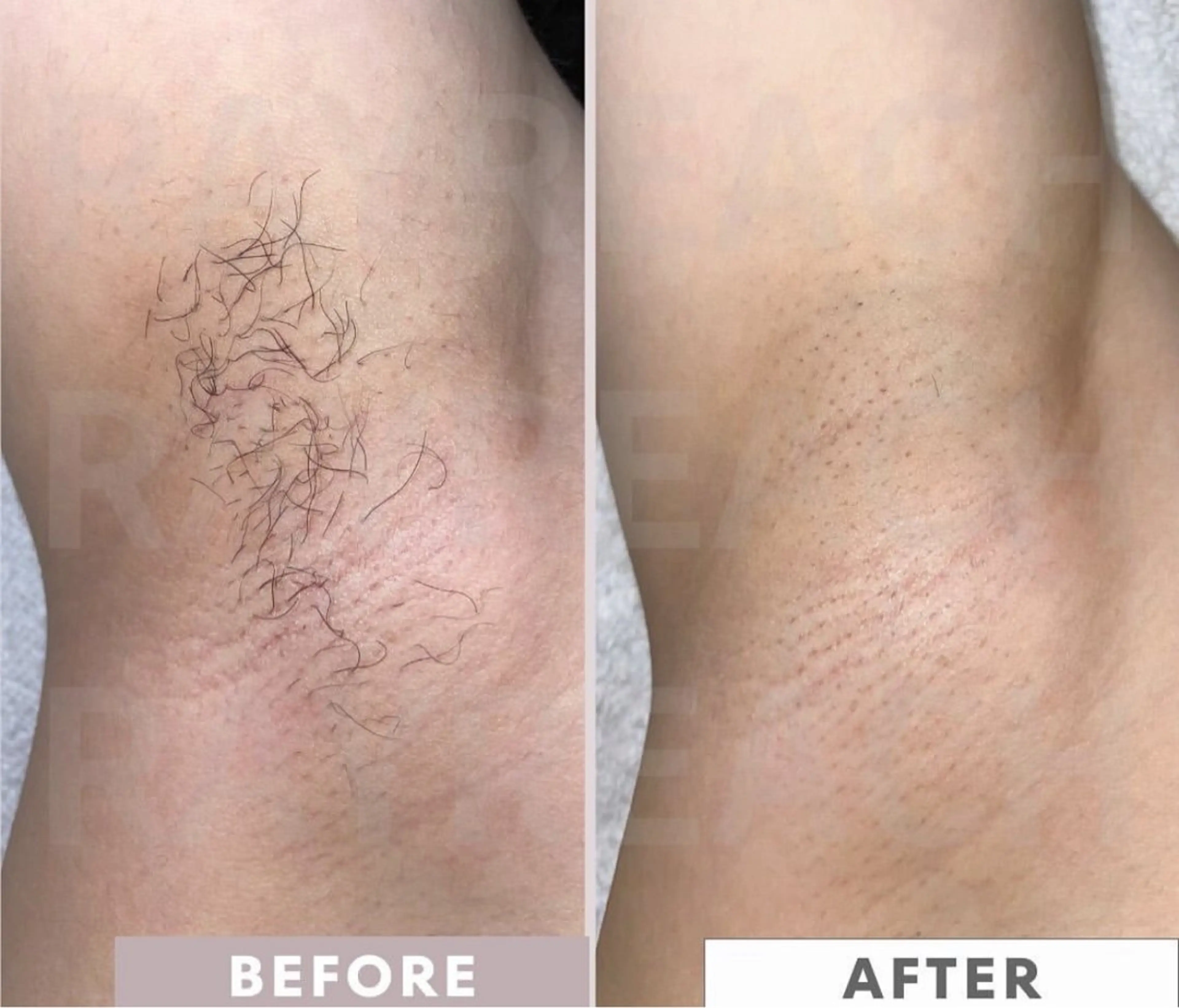 脱毛 【ena】 YUKOのマツエク・マツパデザイン