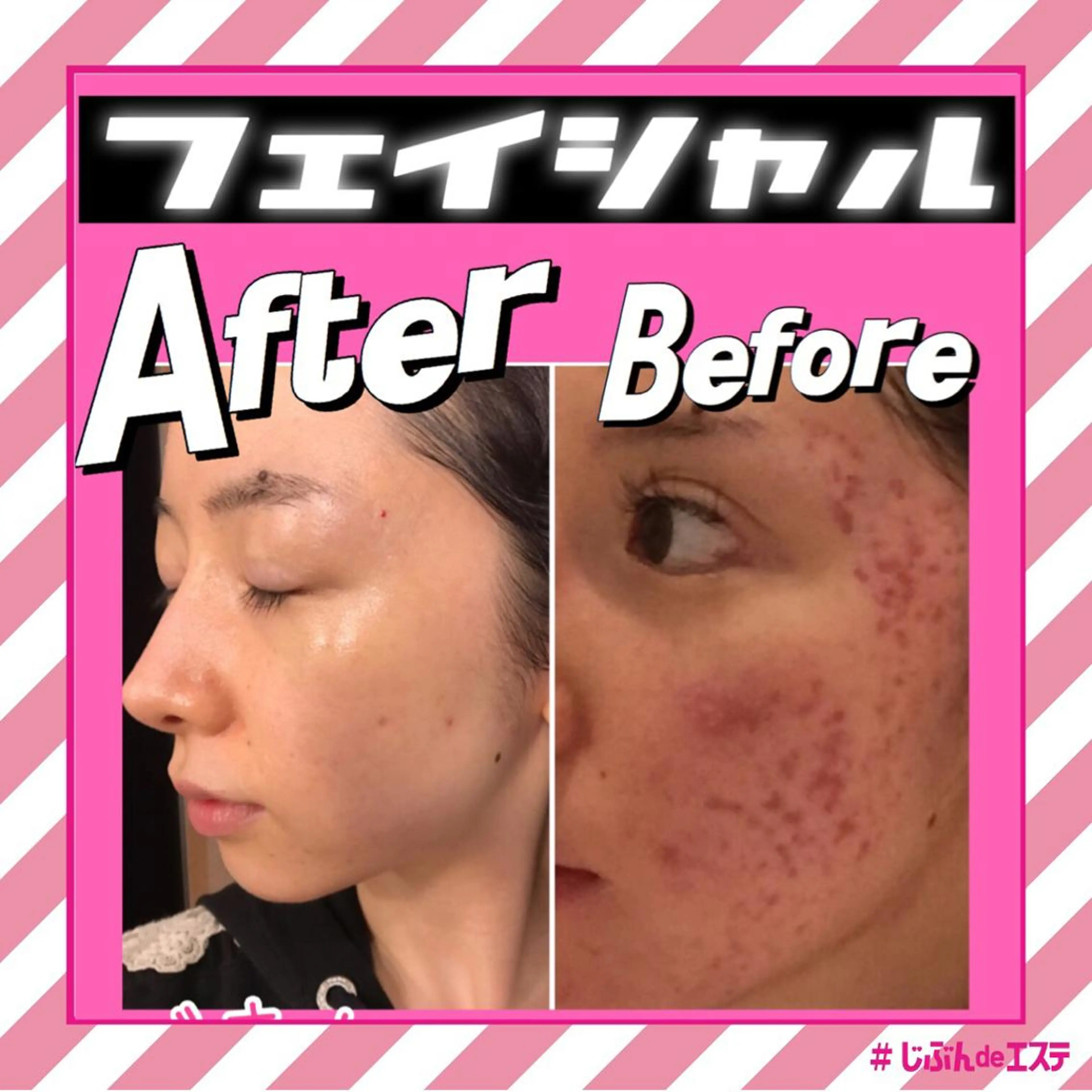 じぶんdeエステ 名古屋PARCO店所属・名古屋パルコ店 じぶんdeエステのエステ・リラクイメージ