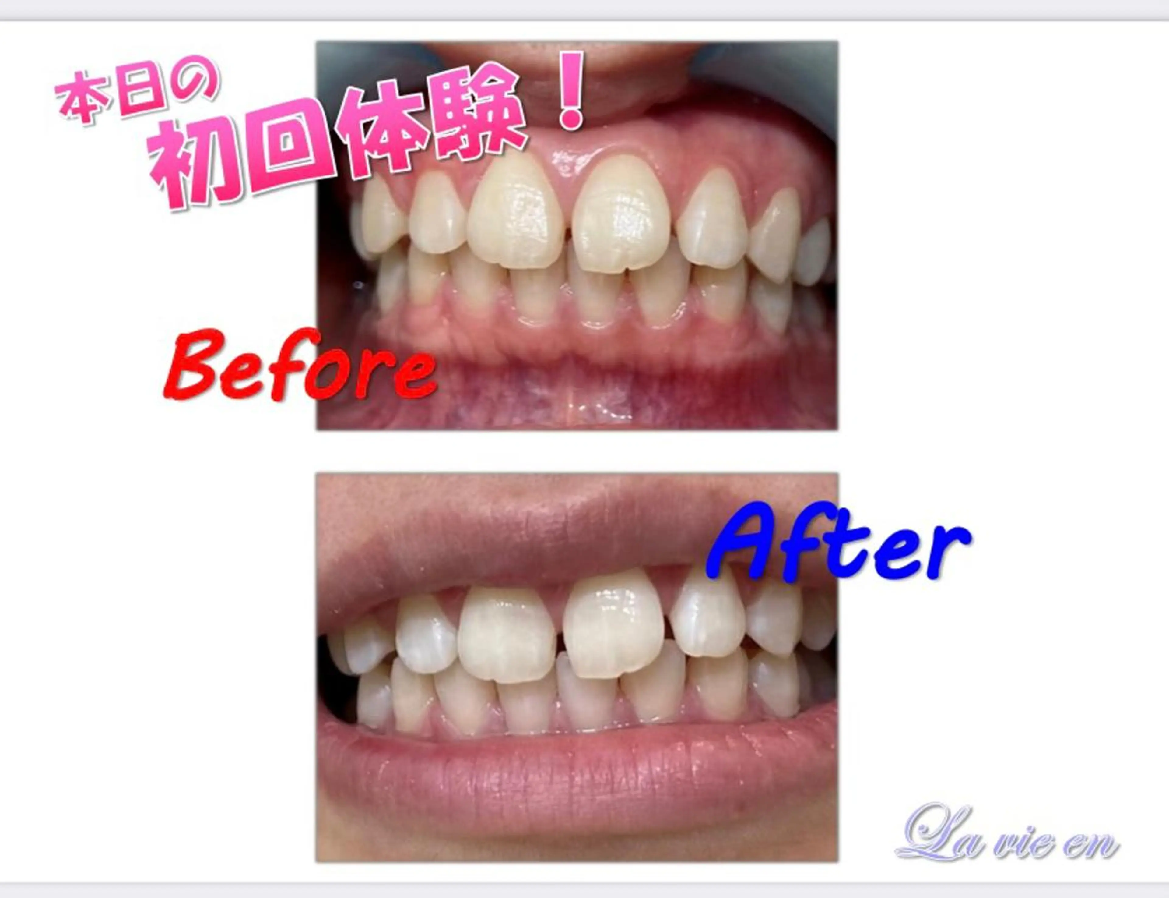 その他 セルフホワイトニングサロン　ラヴィアン所属・ホワイトニングサロン La vie enのその他イメージ