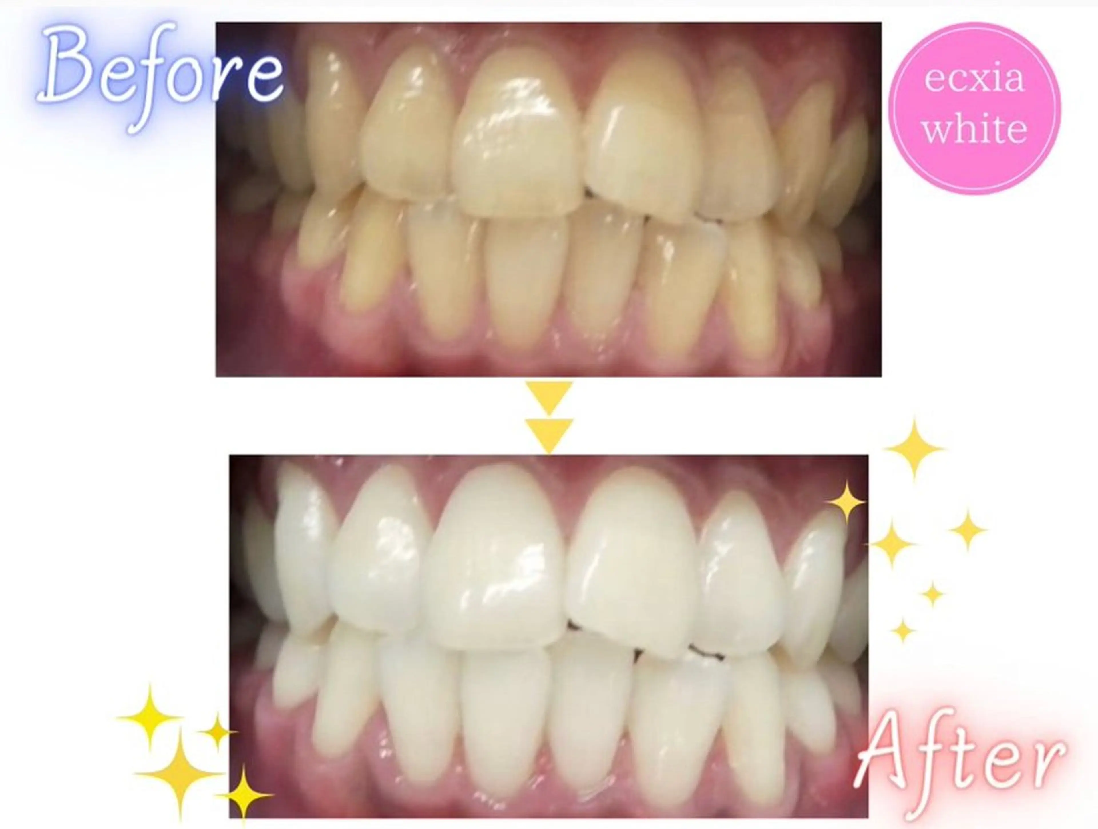 メンズ その他 エクシアホワイトニング草津店所属・nanami -ホワイトニングのその他イメージ