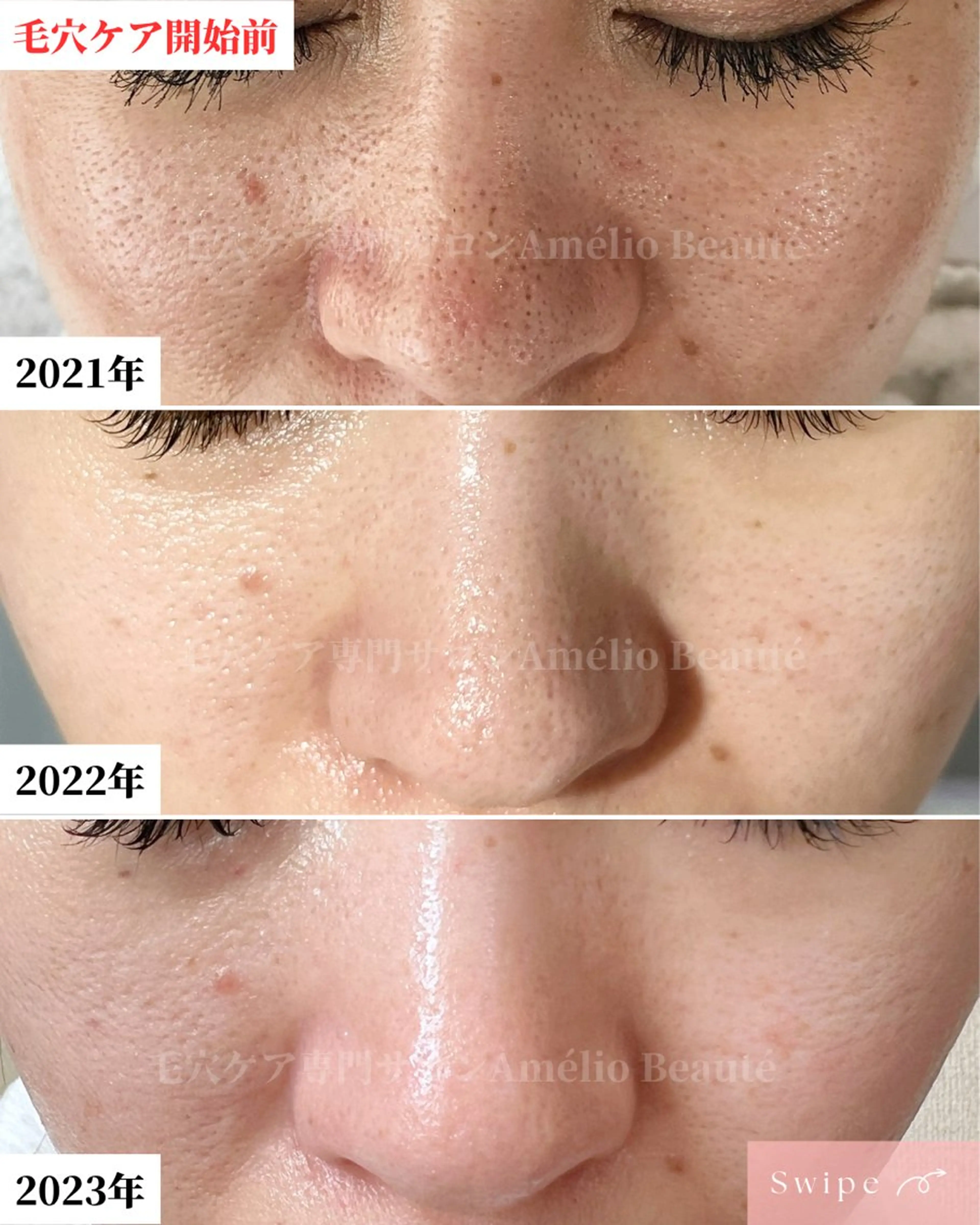 メンズ 毛穴ケア専門サロン Amélio Beauté所属・毛穴ケア専門サロン アメリオボーテのその他イメージ