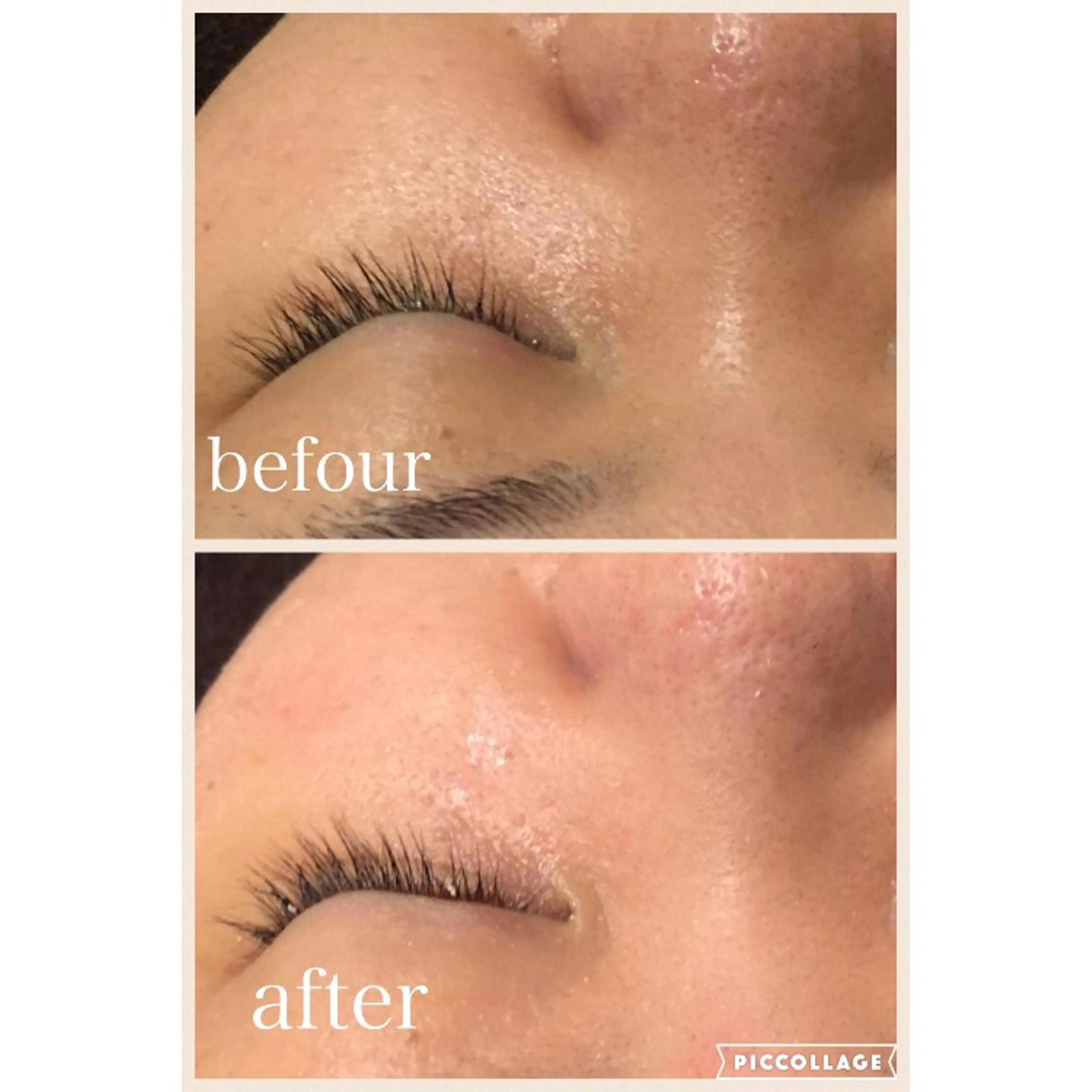 ニキビ跡専門サロン Ａｉｎａのエステ・リラクイメージ