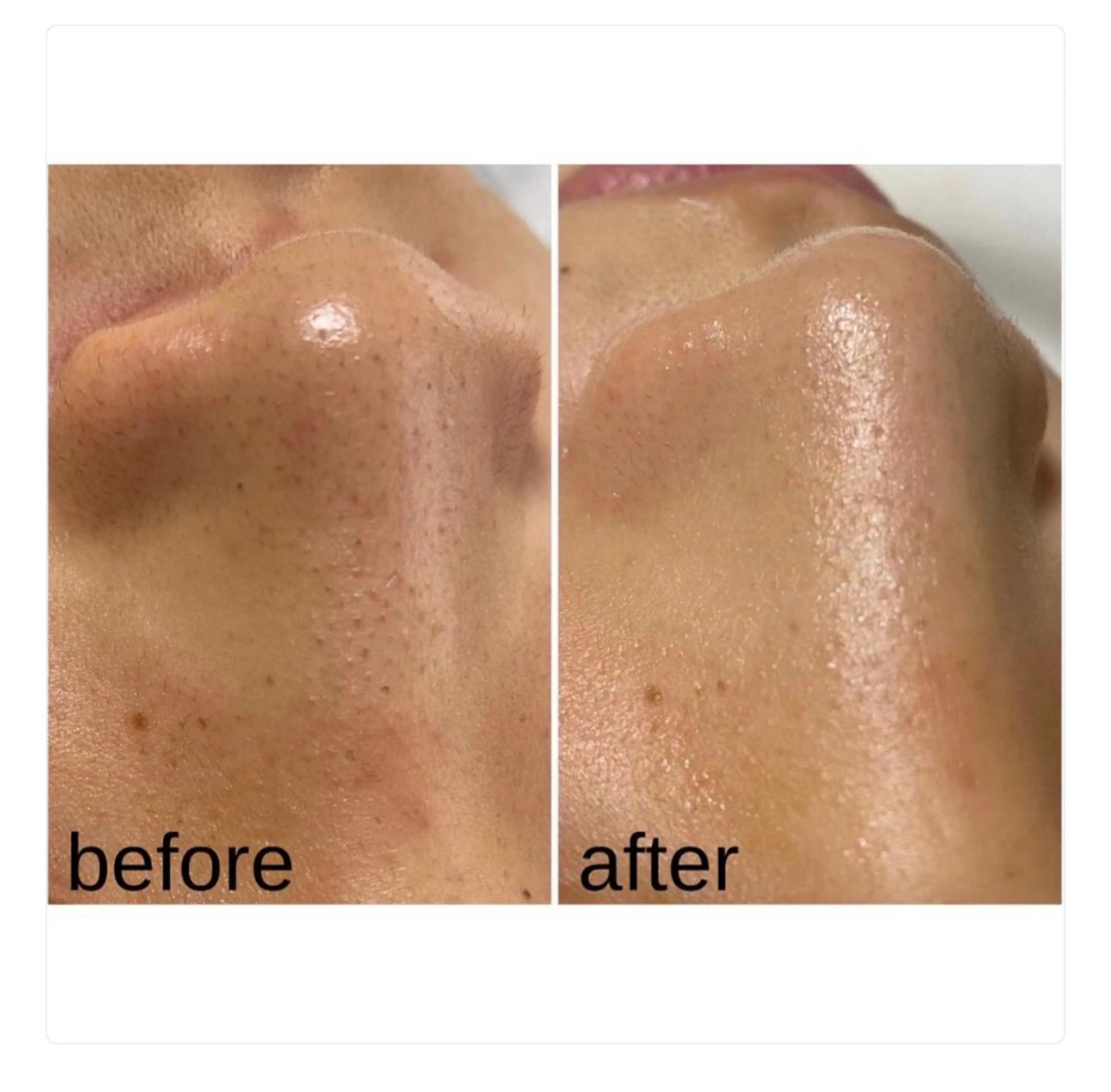 【頭痛、睡眠改善】 salon RUUのエステ・リラクイメージ