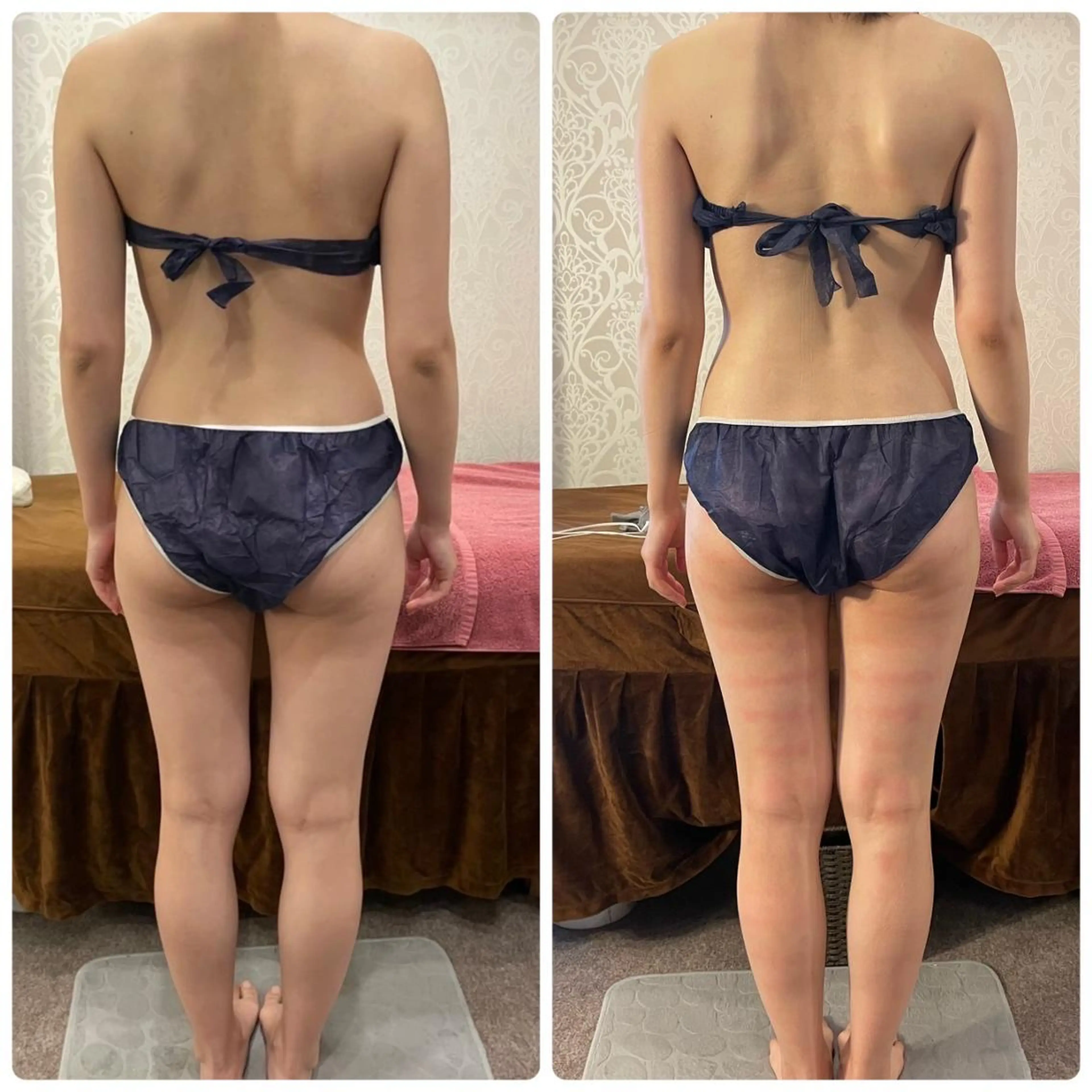 エステ リラク FLEUR大阪・美容 整体・痩身・小顔のエステ・リラクイメージ