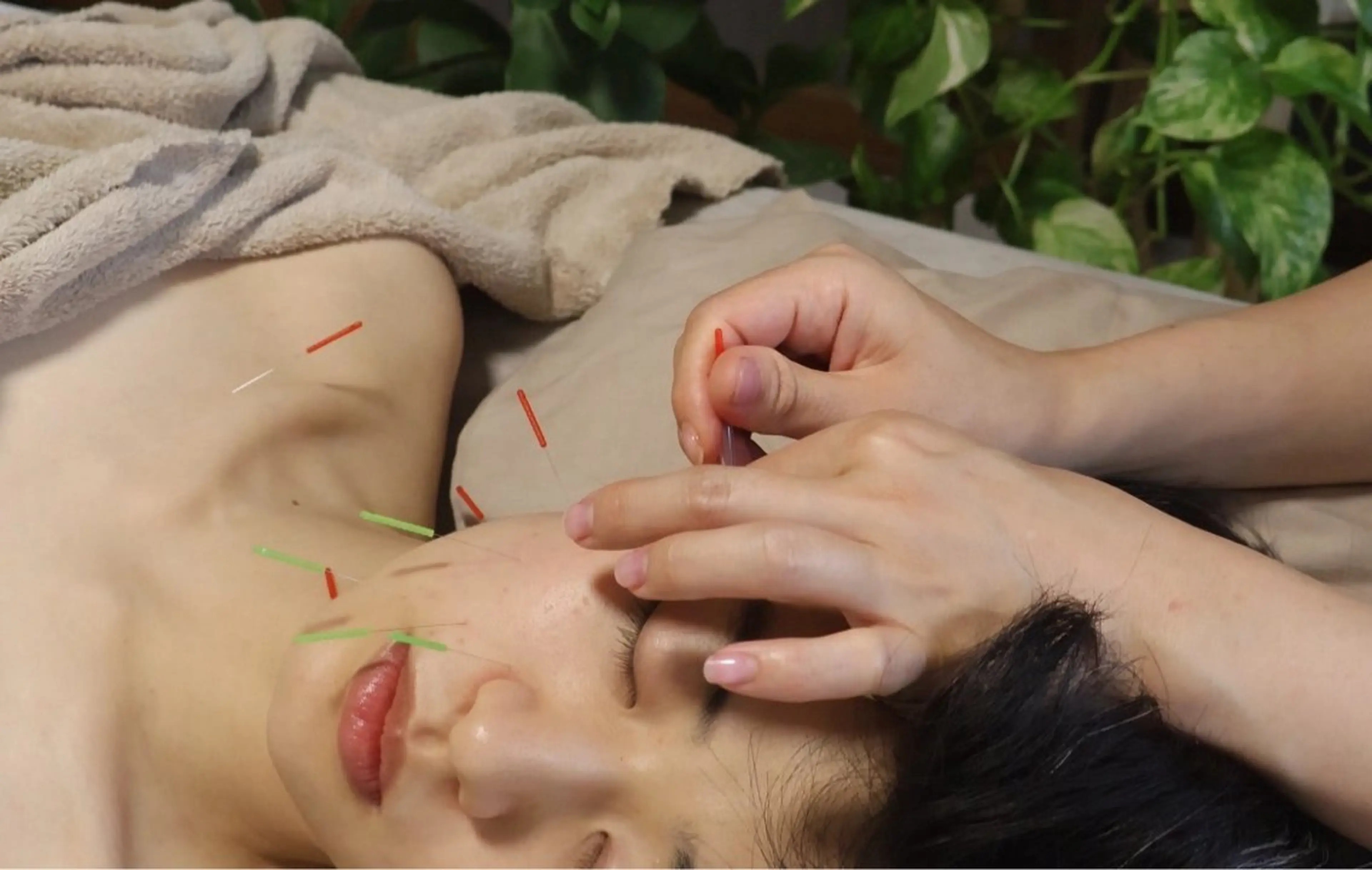 回数券コース🎫✨リフトアップ美容鍼60分3回券👉¥27,800(こちらのコースは頸・デコルテオイル付きです)の写真