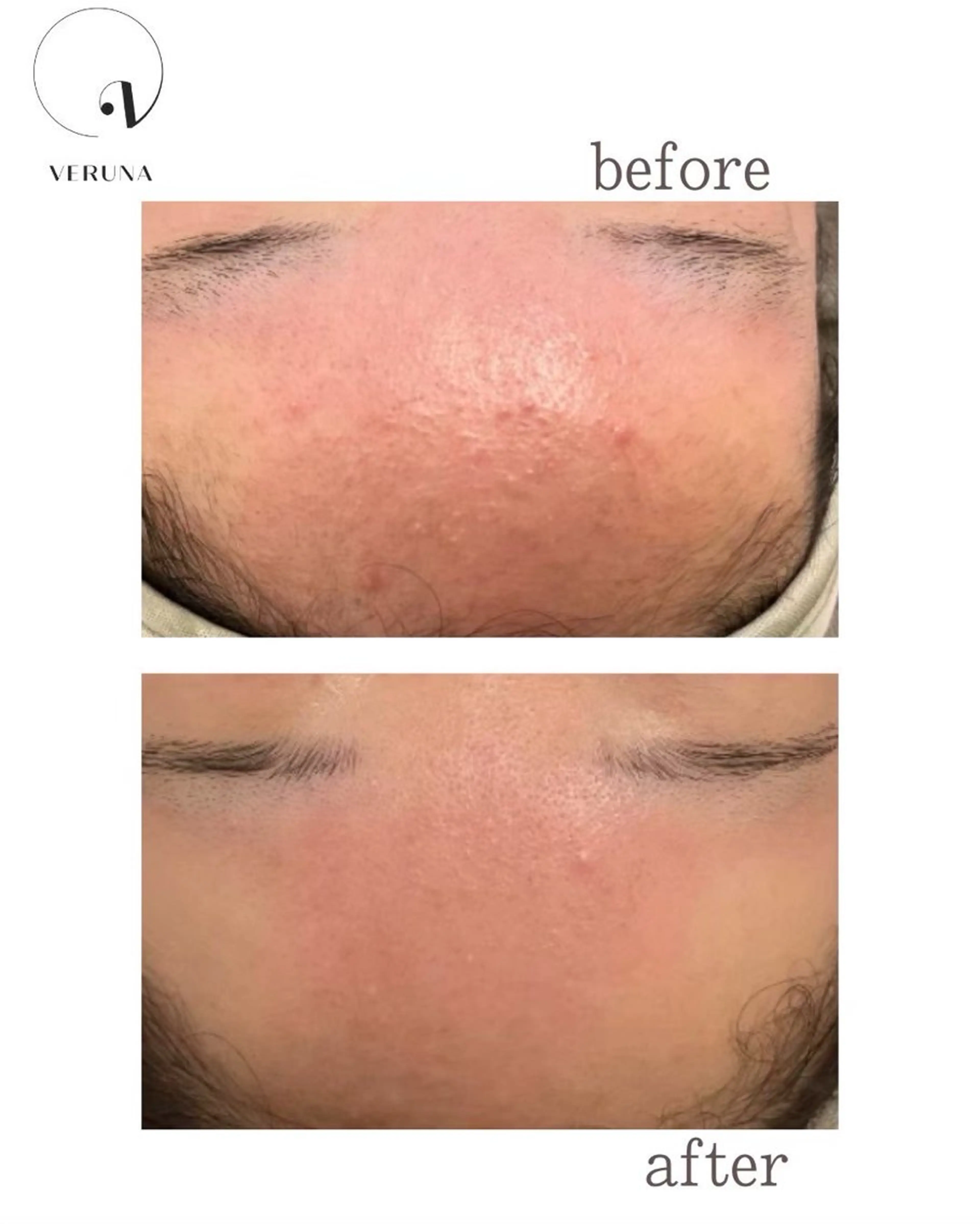 オーダーメイドハーブ ピーリングOPEN✨のエステ・リラクイメージ