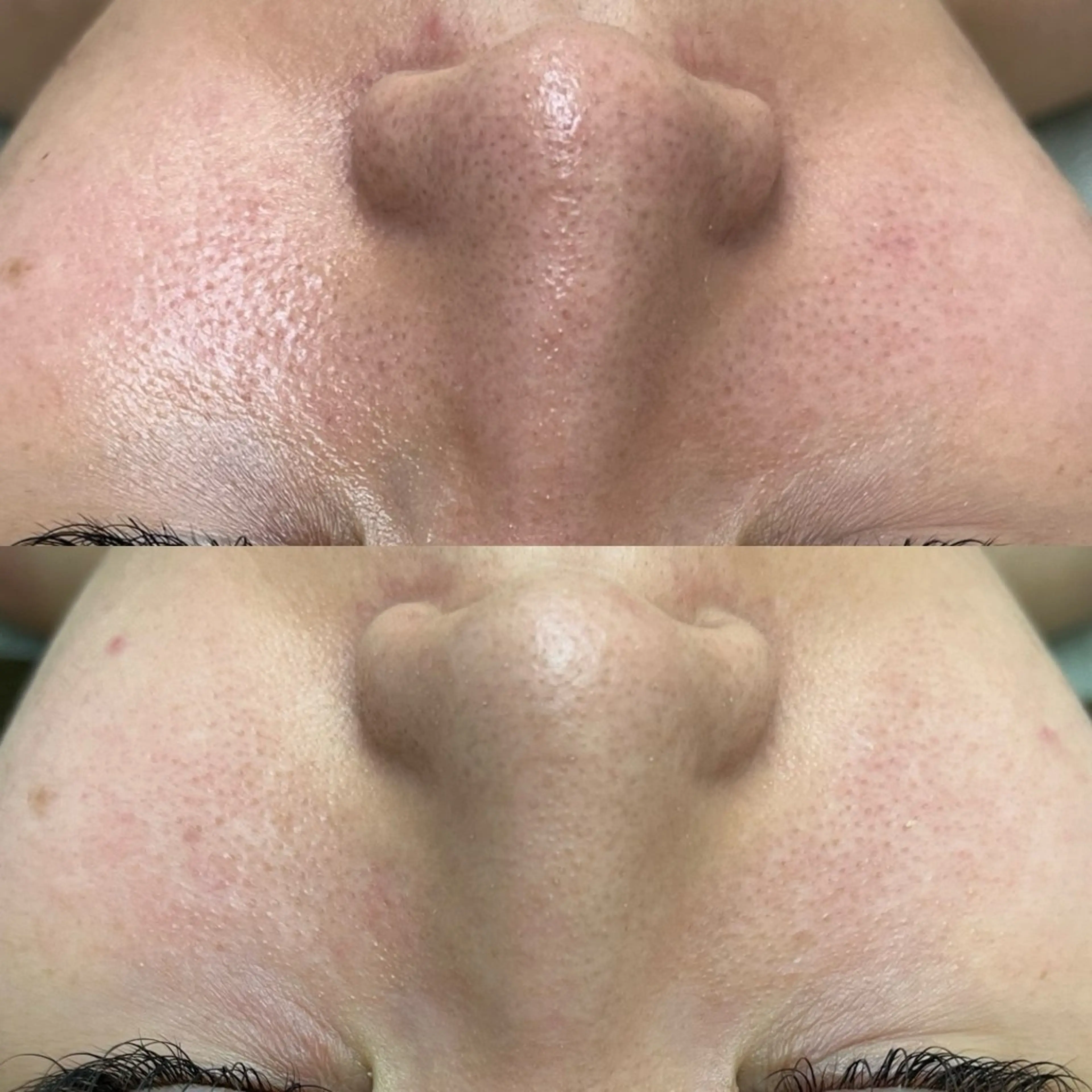 エステ Beauty Salon Ciel　Chiba所属・BeautySalo nCielChibaのエステ・リラクイメージ