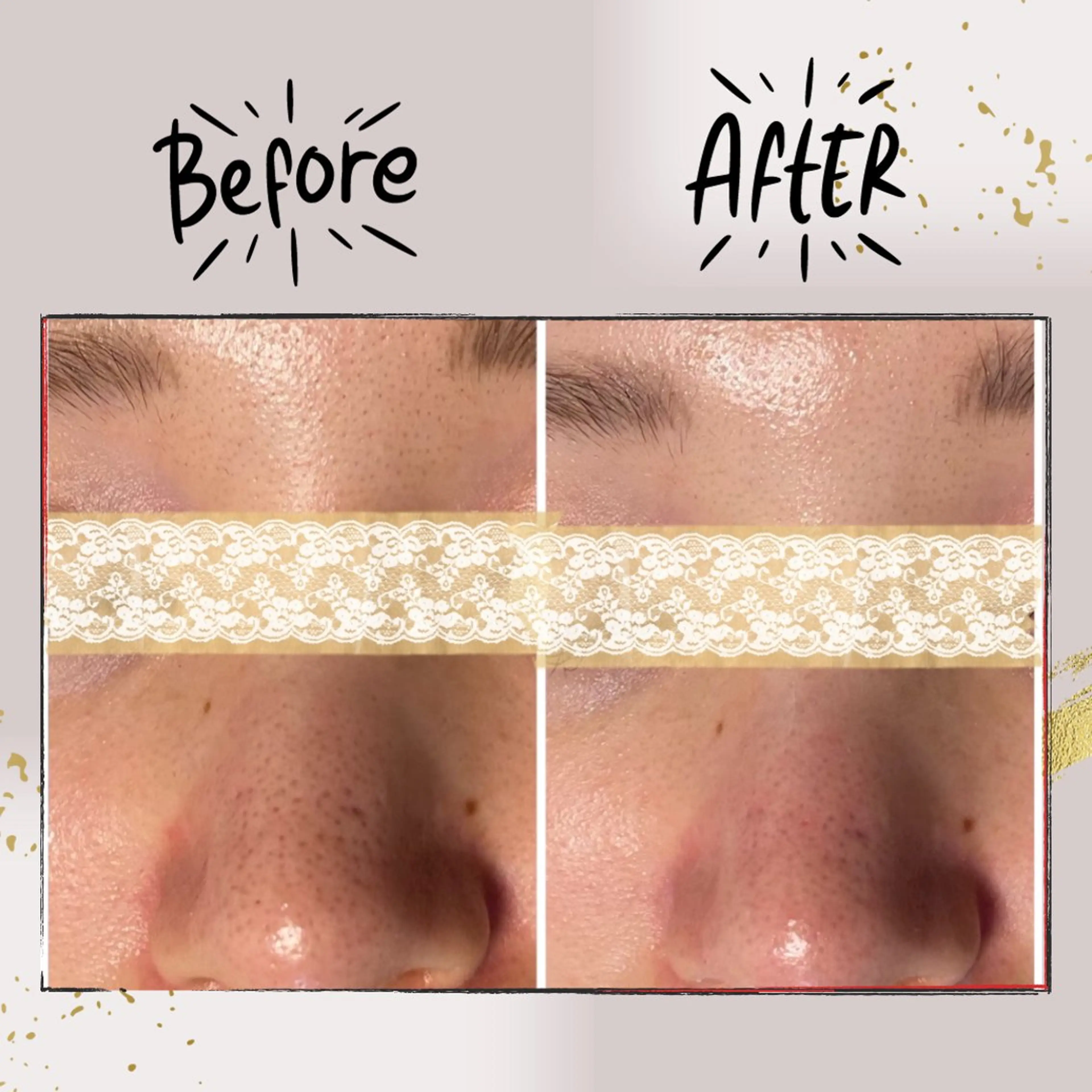 エステ リラク ピーリング専門店 Belluteのエステ・リラクイメージ