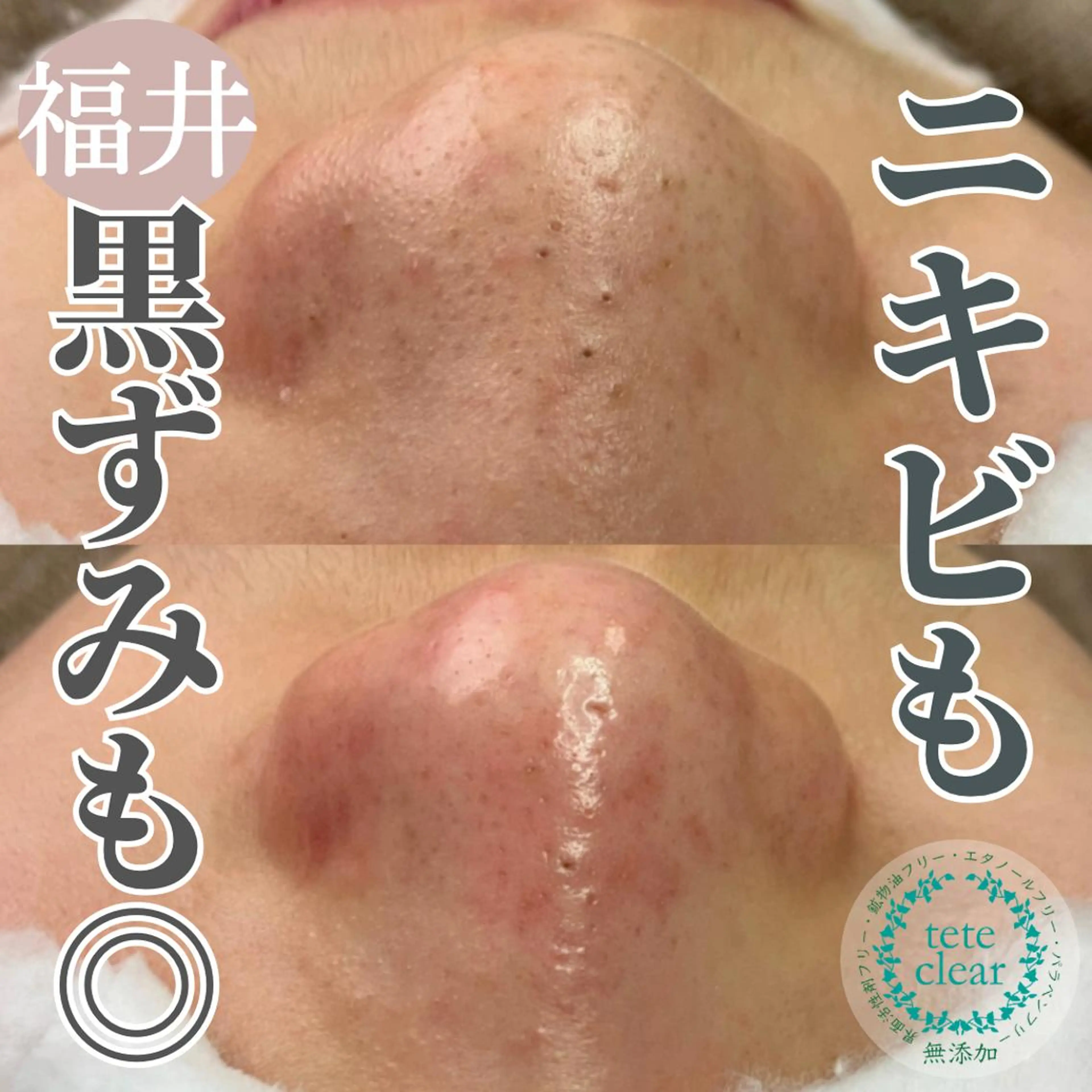 毛穴肌質ケアサロン Yourmeユアミーのエステ・リラクイメージ